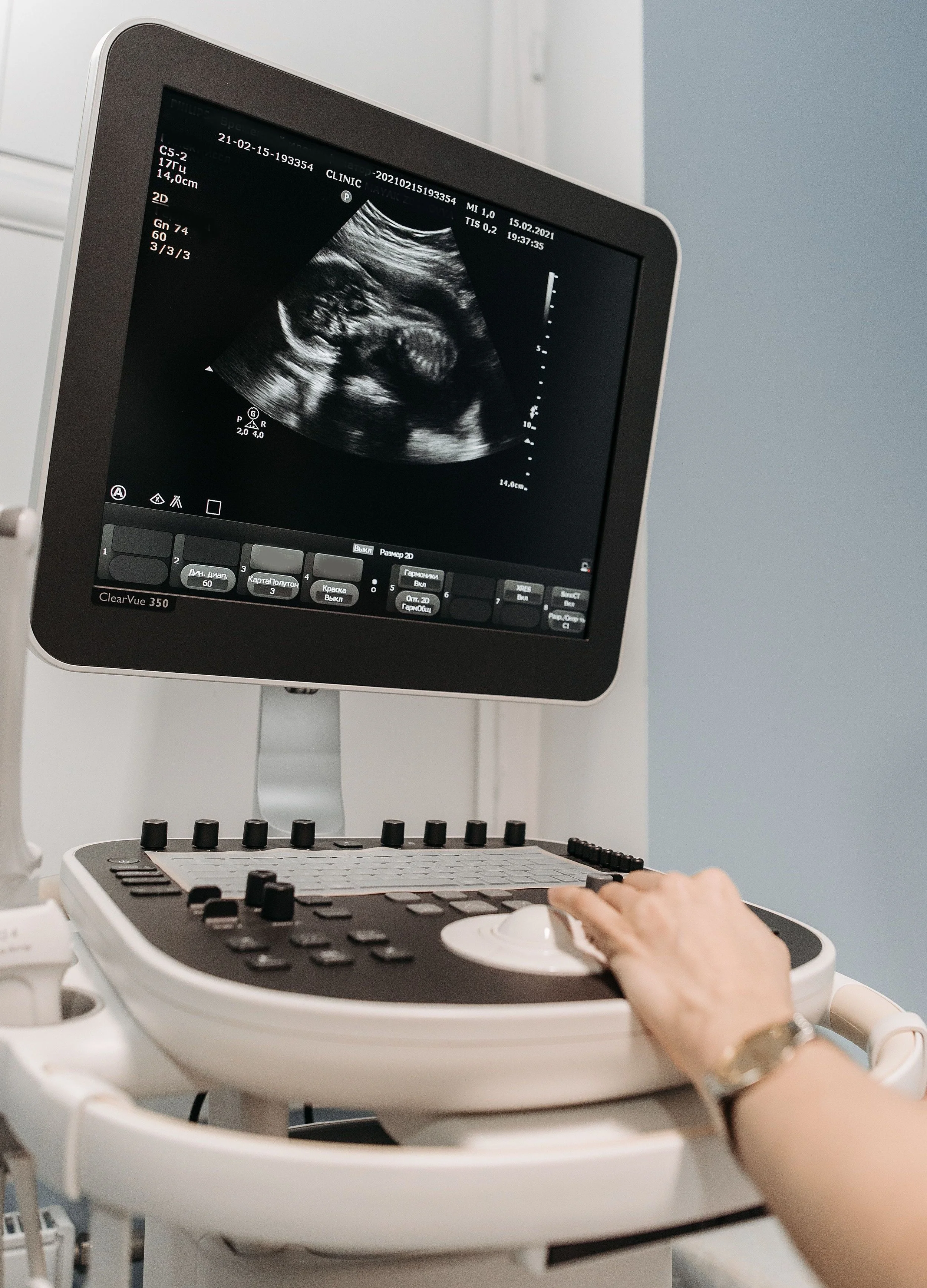 An ultrasound