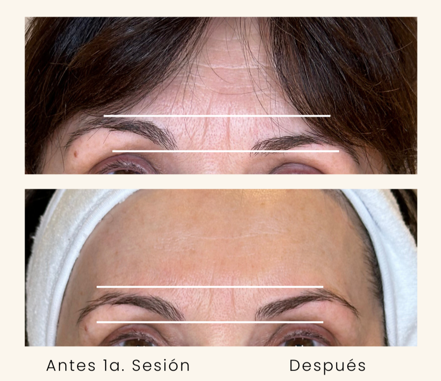 tratamientos corporales en Zaragoza