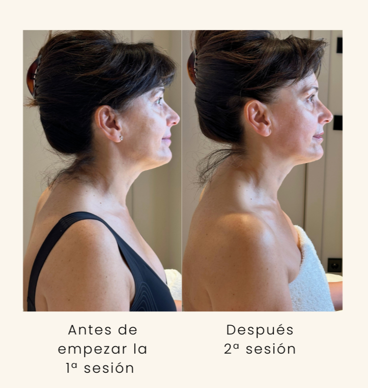 tratamientos corporales en Zaragoza