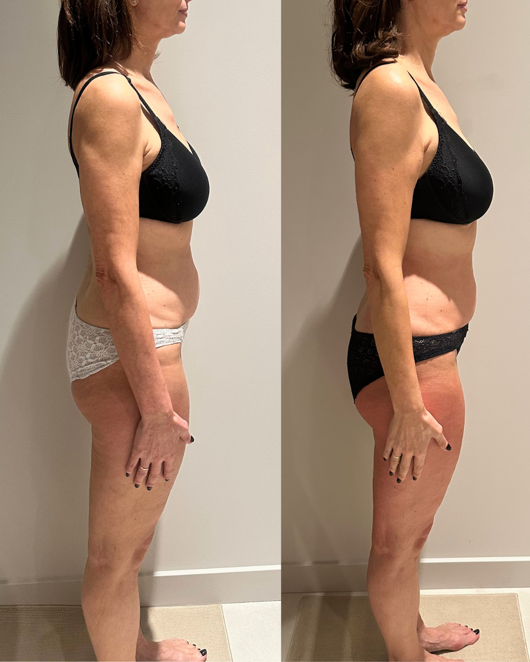 tratamientos corporales en Zaragoza