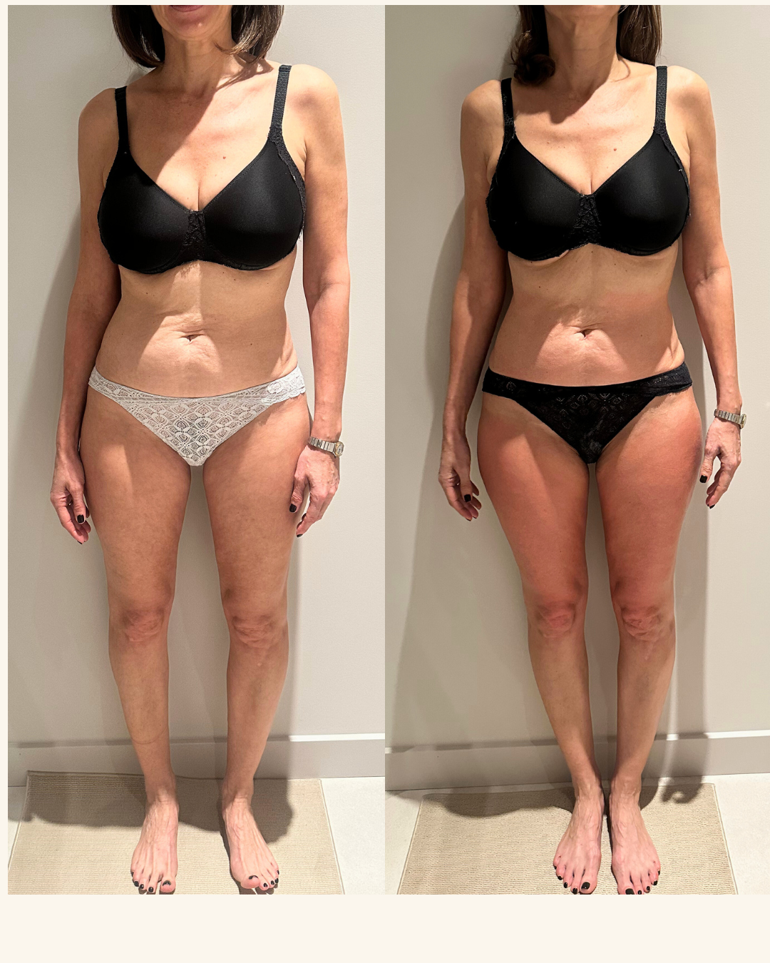 tratamientos corporales en zaragoza