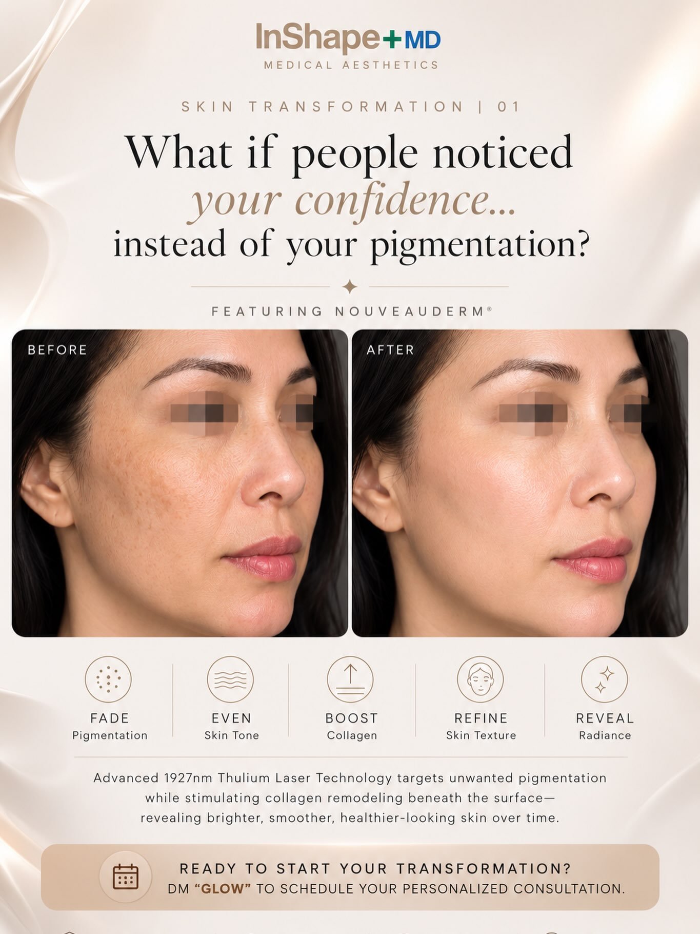 Skin Transformation | 01

What if people noticed your confidence&hellip; instead of your pigmentation?

Melasma isn&lsquo;t just about darker patches on your skin.

It&rsquo;s hesitating before taking a photo.

It&lsquo;s reaching for foundation ever