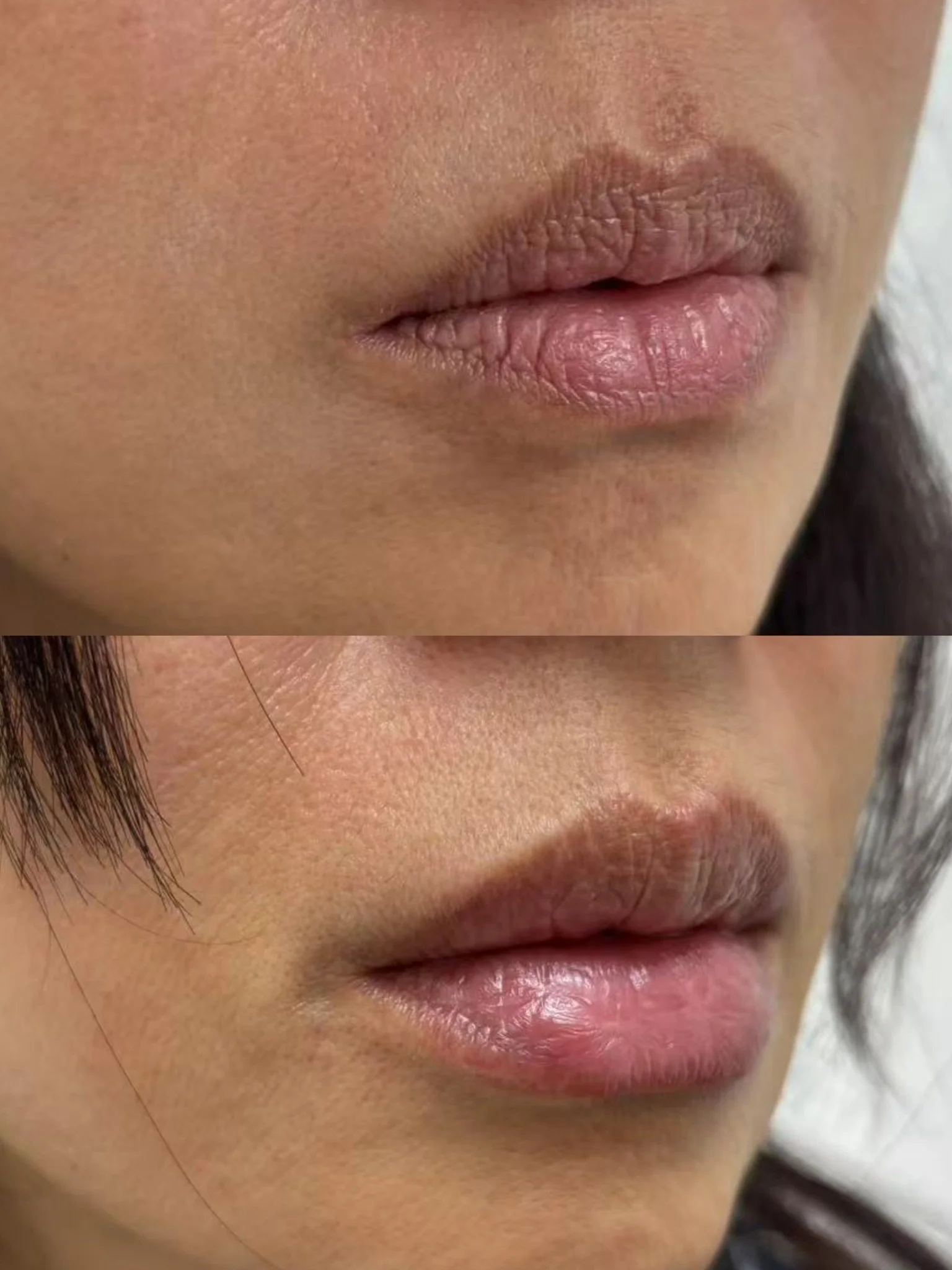 Nature Lip Hydration