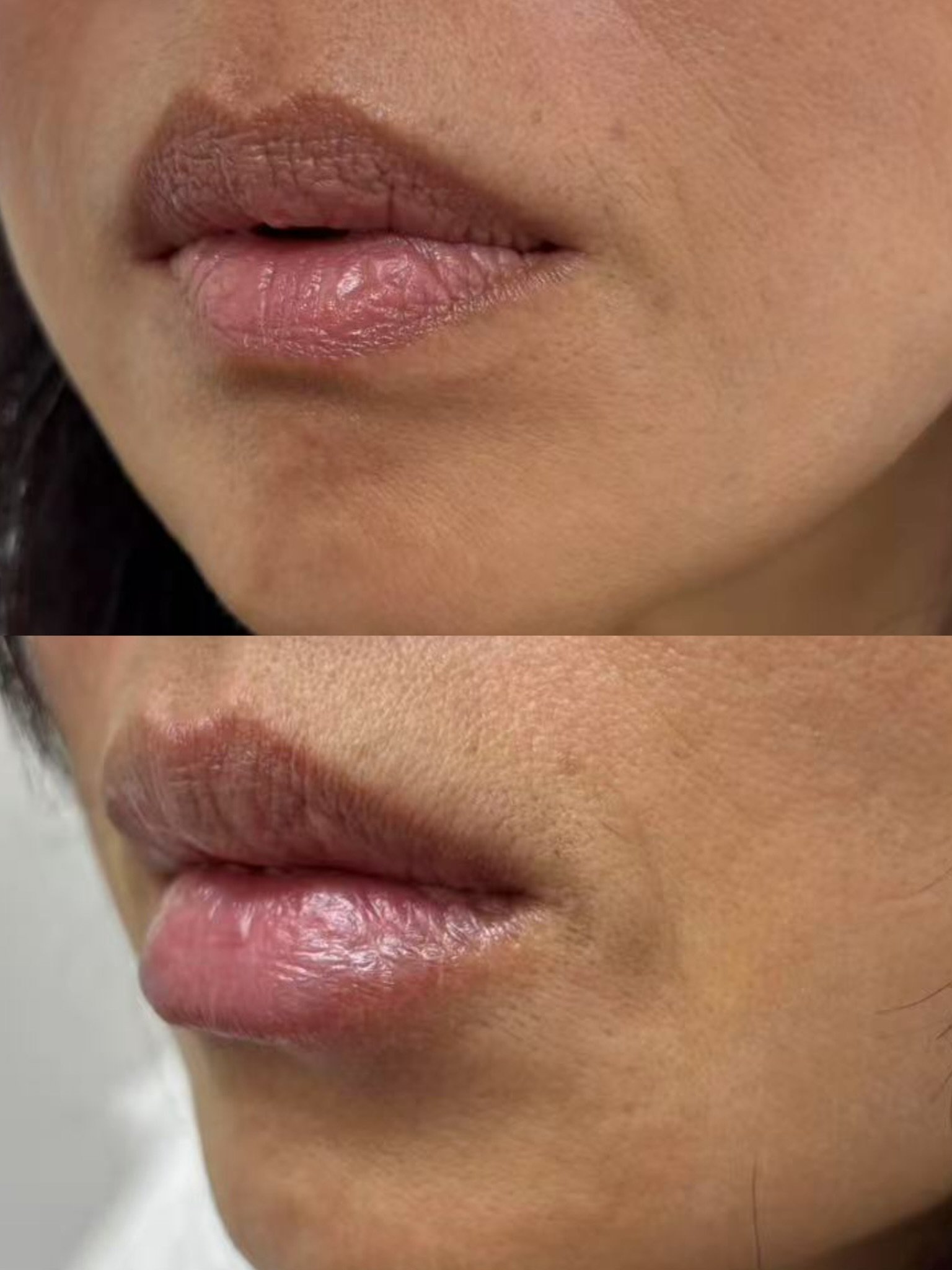 Nature Lip Hydration
