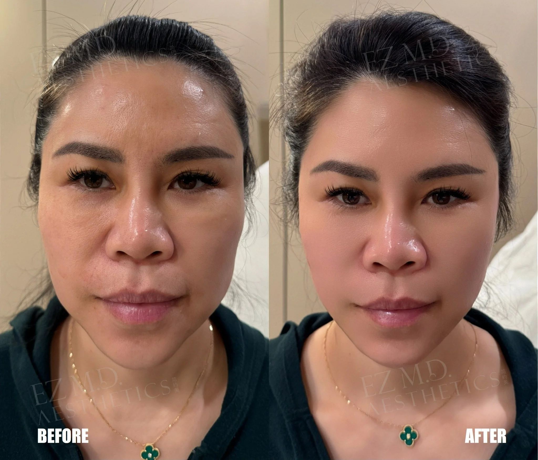 Full Face PDO Thread