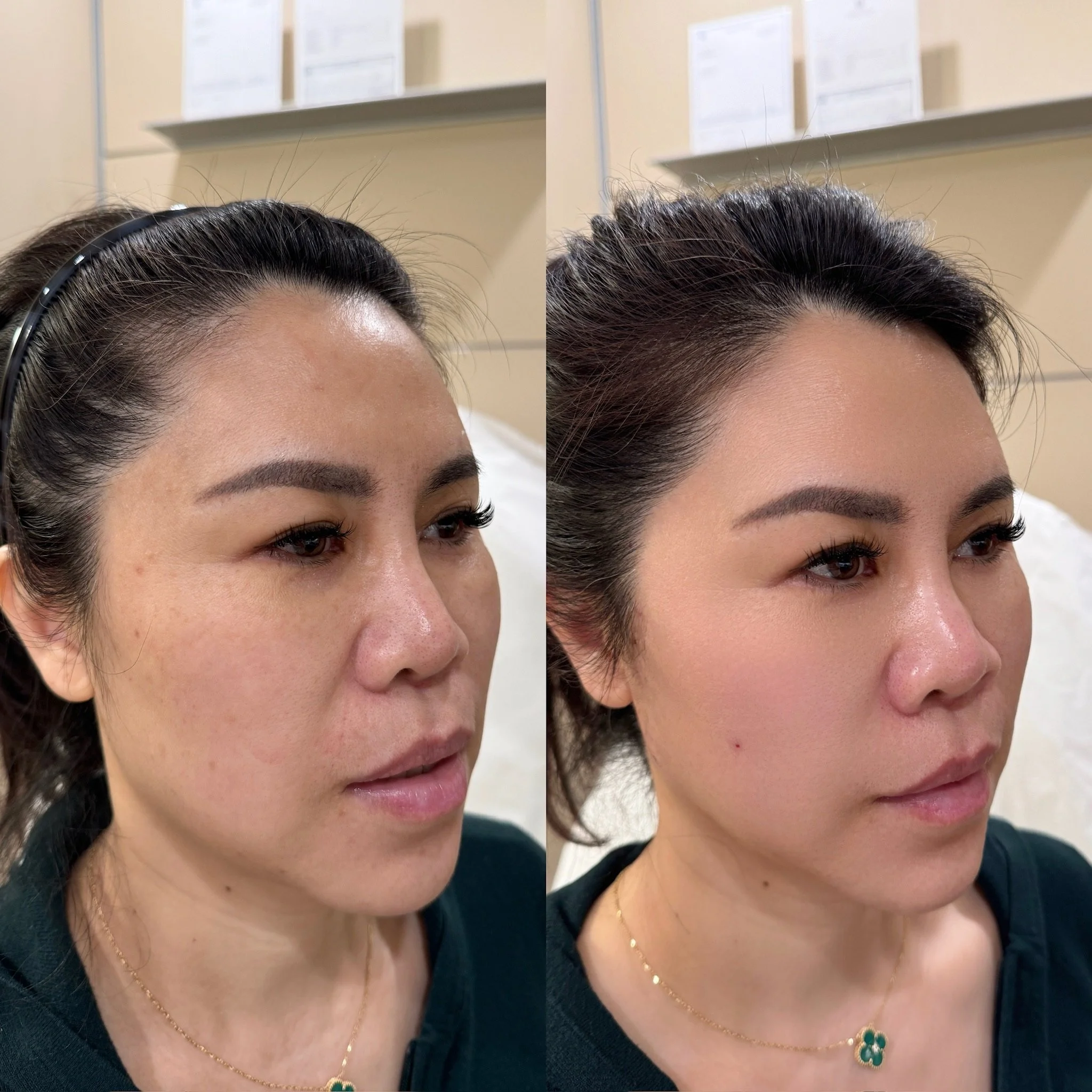 Full Face PDO Thread