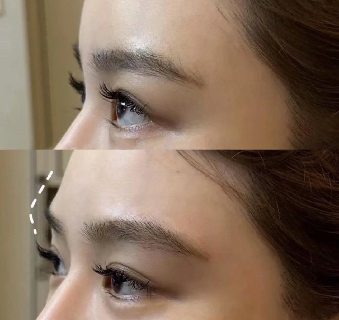 Brow Bone Contouring