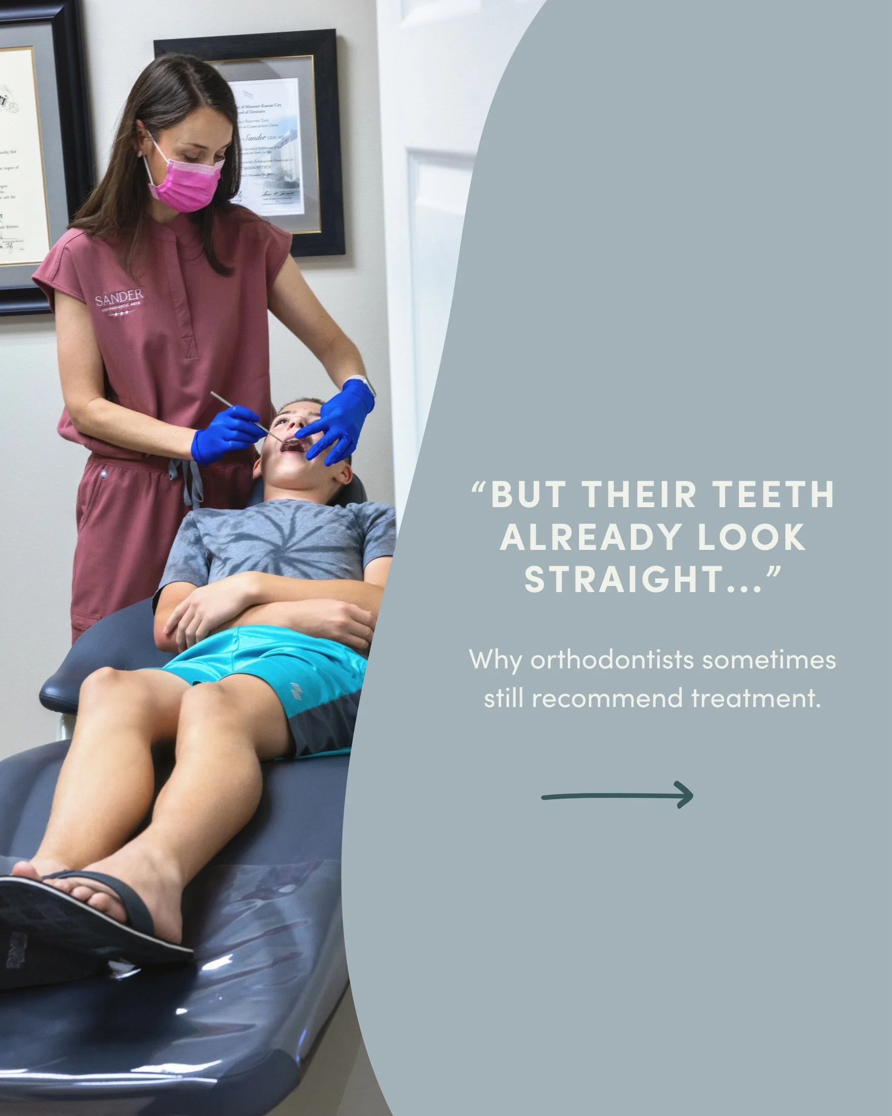 One of the most common things we hear at consultations is:

&ldquo;But their teeth already look straight&hellip;&rdquo;

And honestly? Sometimes they do 

But orthodontics is about much more than what&rsquo;s visible in a photo.

We evaluate jaw deve