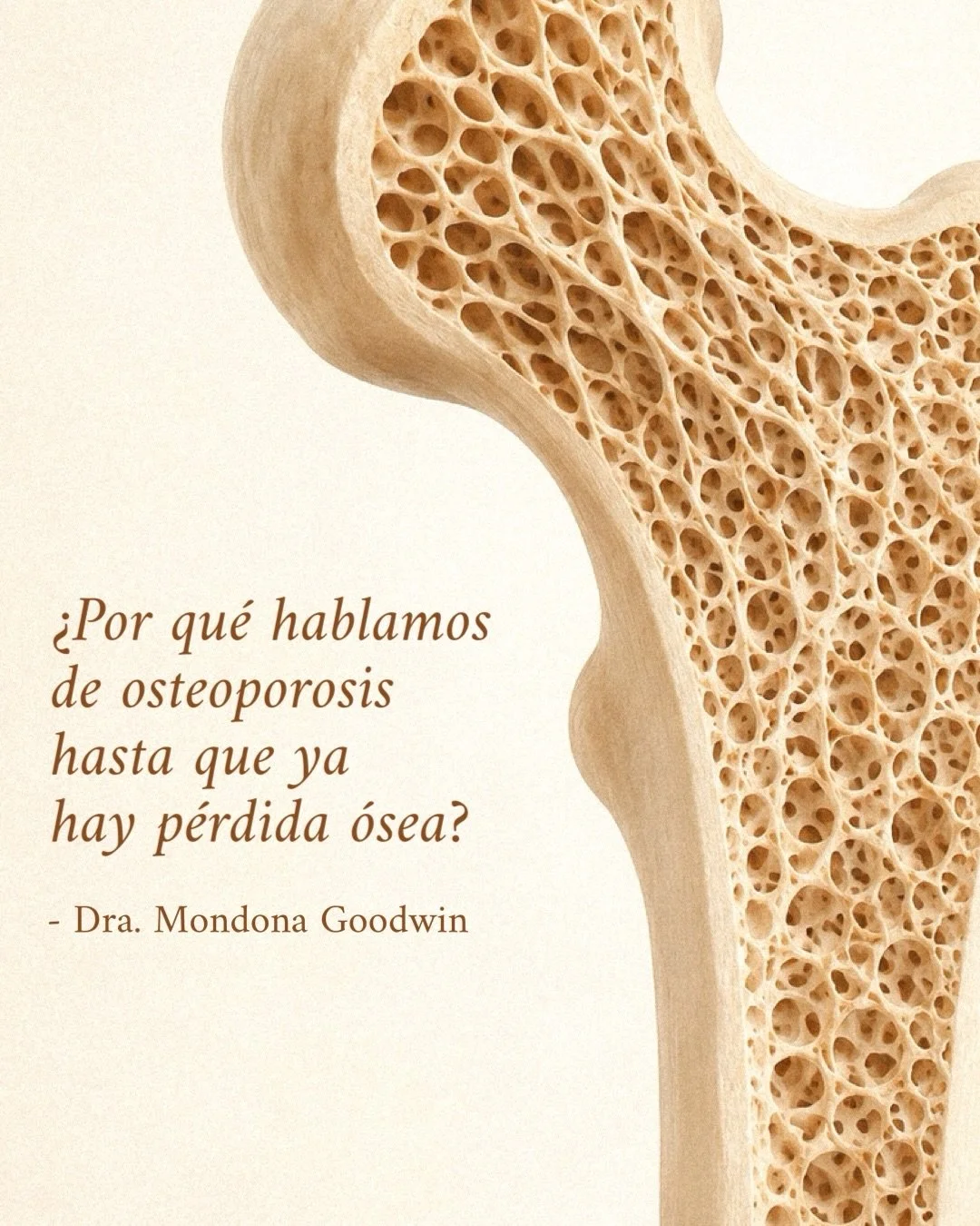 &iquest;Por qu&eacute; hablamos tan poco de prevenir la osteoporosis? 🦴

La p&eacute;rdida &oacute;sea se acelera durante la perimenopausia, desde 1 a 2 a&ntilde;os antes de la &uacute;ltima menstruaci&oacute;n).

Como doctora funcional, una parte i