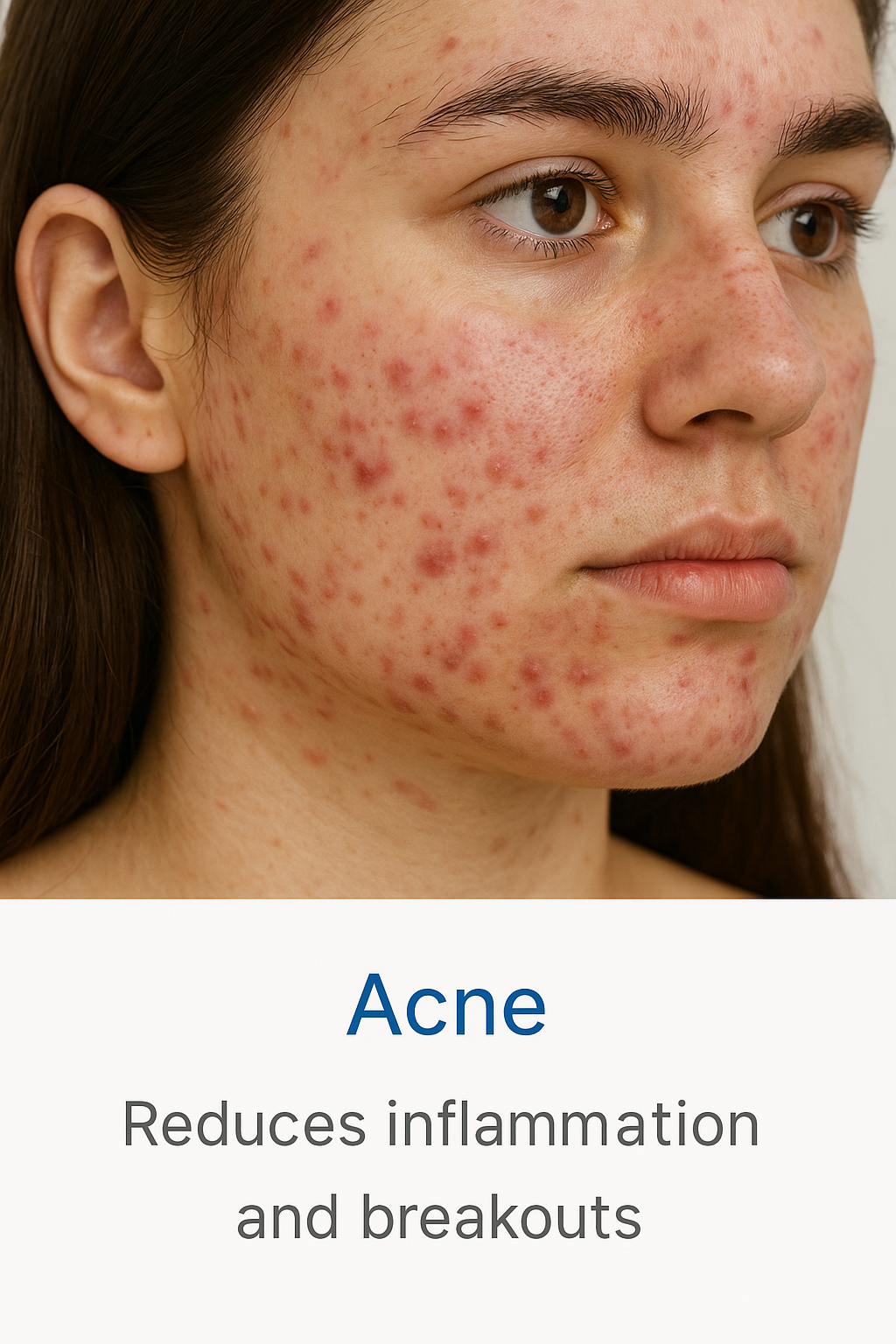 best doctor for acne treatment in texas