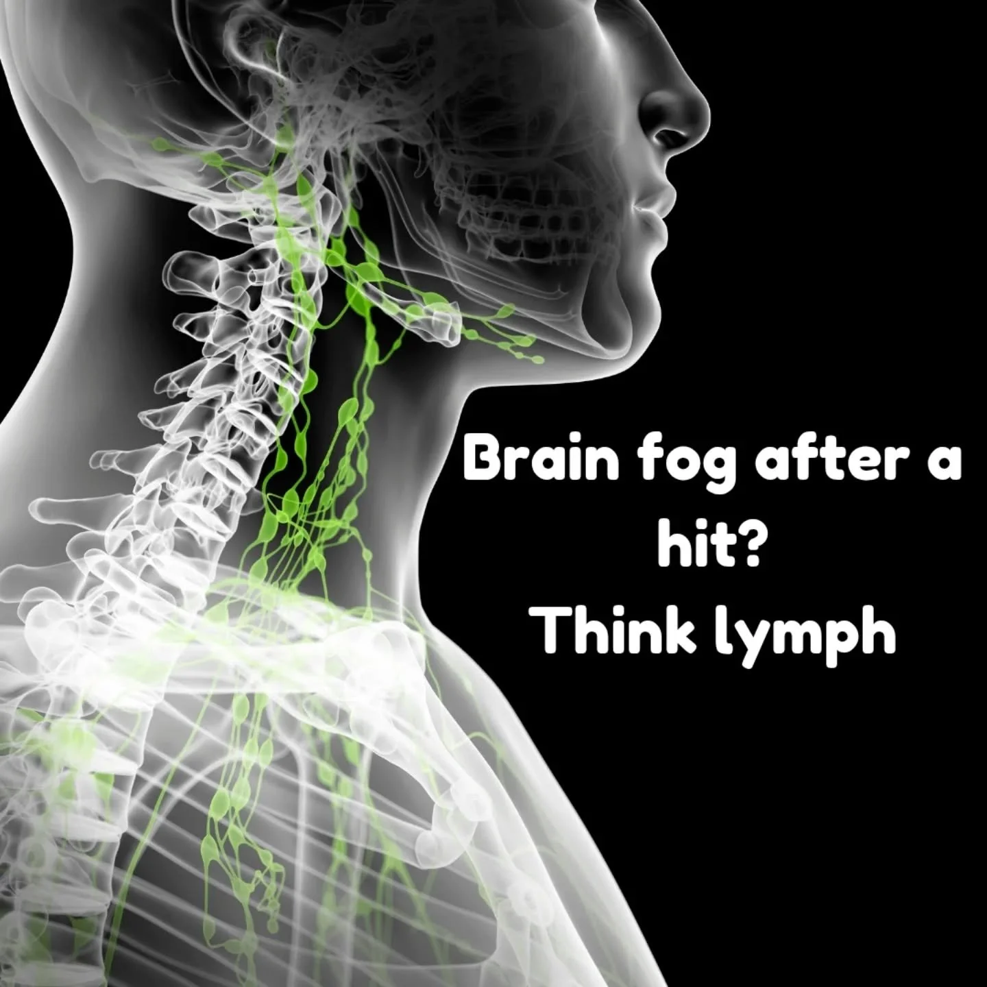 Concussions don&rsquo;t just affect the brain 🧠

They create inflammation throughout the body. When lymph flow slows, fluid can start to pool and pressure builds in the system. 🔥

That pressure can show up as headaches, brain fog, poor sleep, and t