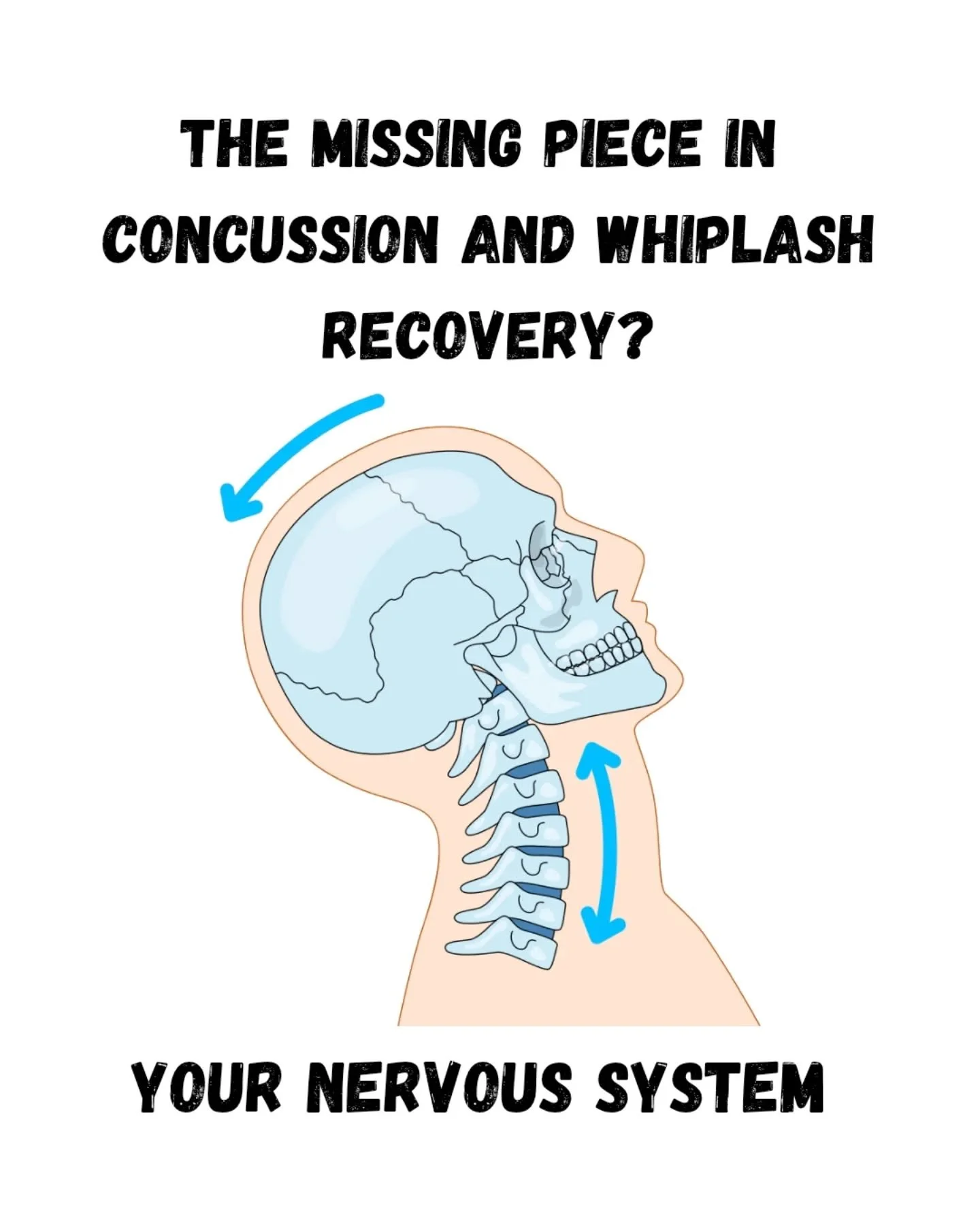 Concussion and whiplash symptoms don't always persist because the injury hasn't healed.

Sometimes the body is still running protective strategies long after they're needed.

That's why I look beyond the symptoms and focus on what's happening within 