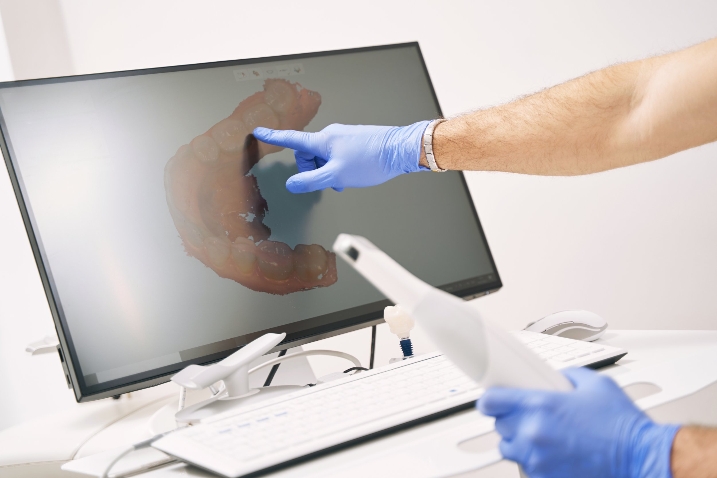 Why I Use Digital Scanners