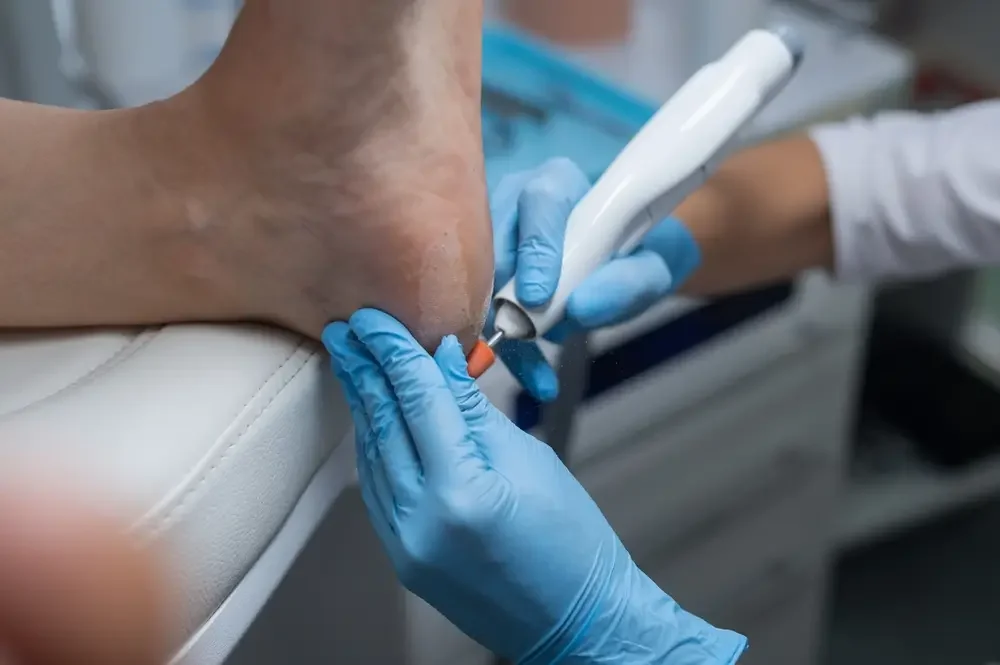 Top 10 Common Foot Conditions Treated by Podiatrists