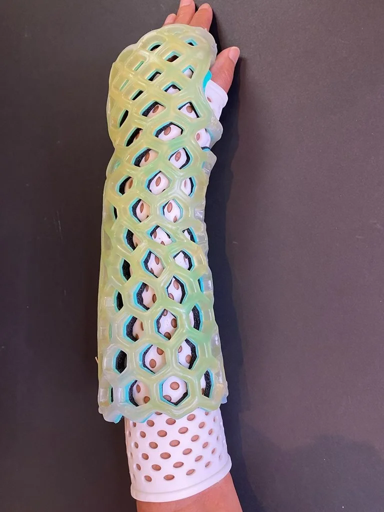 A robotic or prosthetic arm with a green, honeycomb-like exoskeleton covering a white sleeve with brown eyelets.