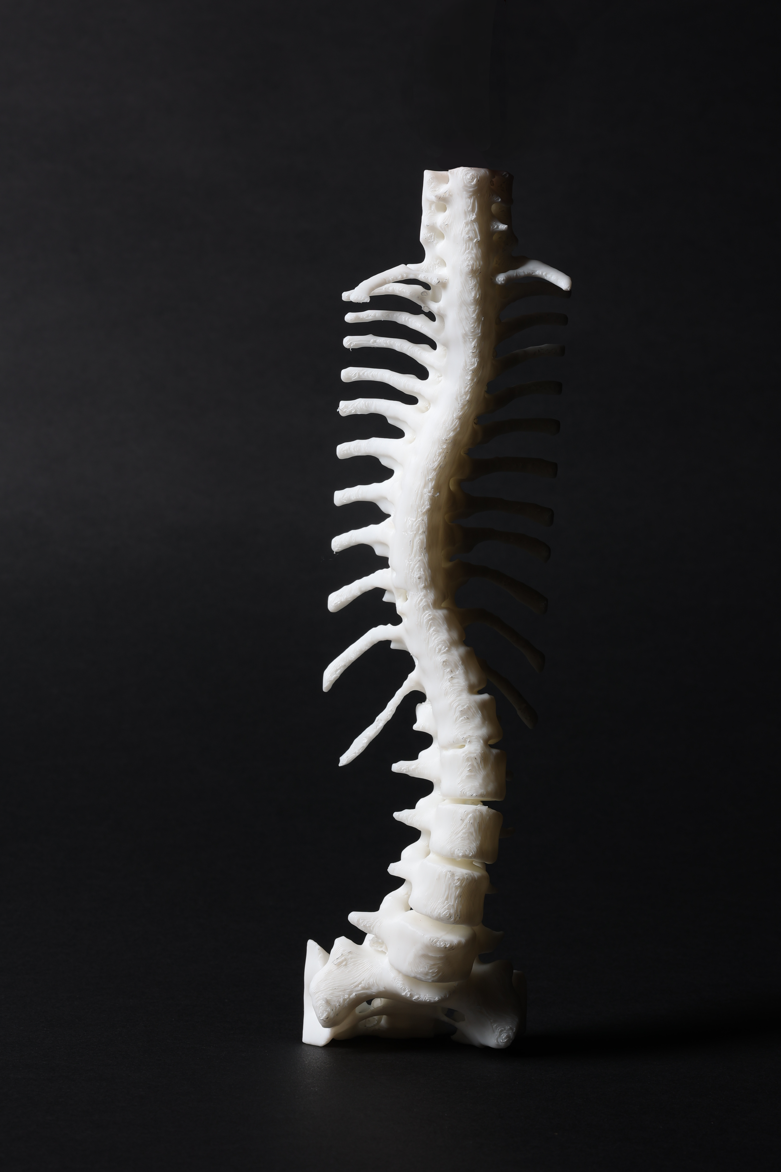 Defining Practice - 3D Scoliosis Spine