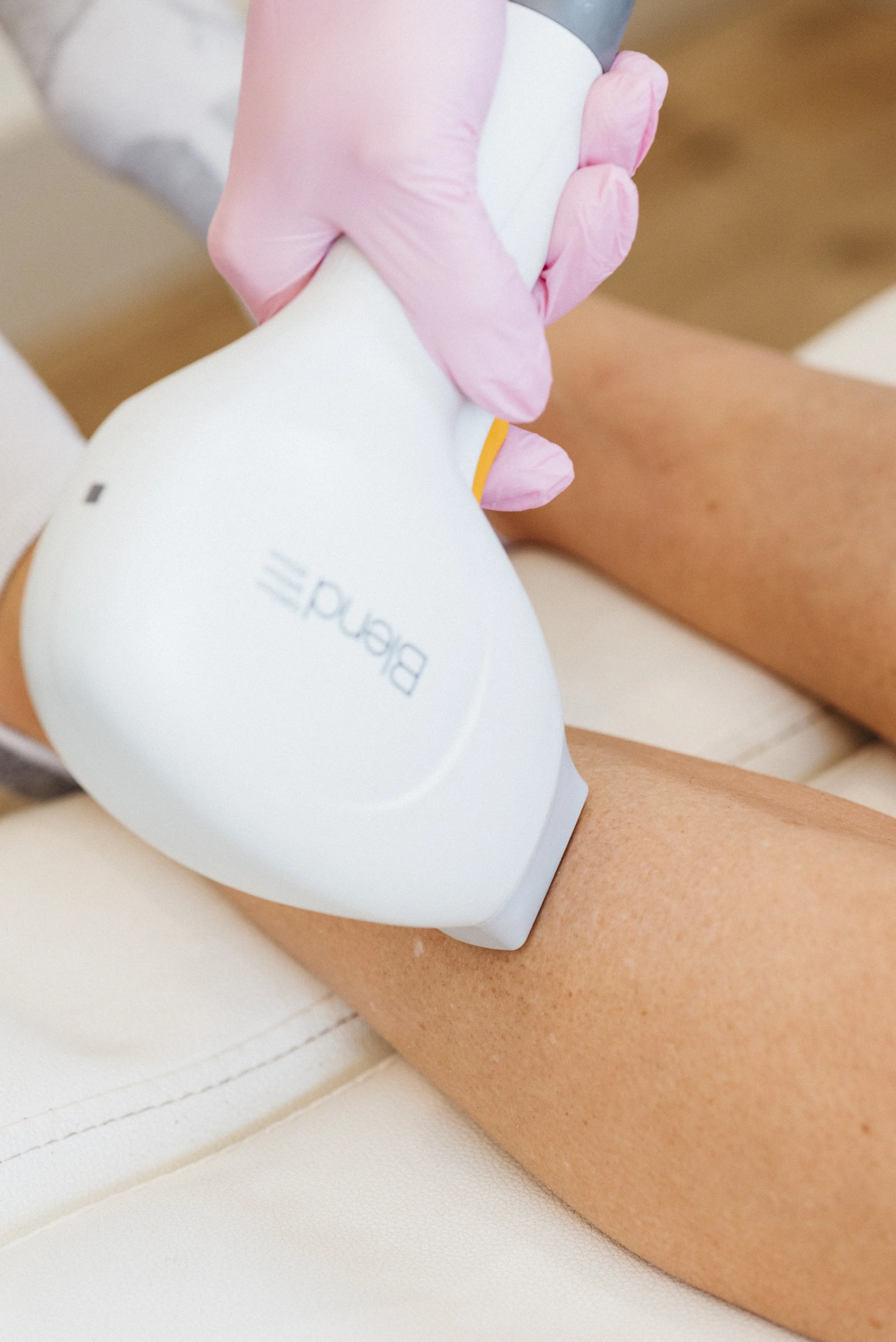 Close-up of a person receiving a laser skin treatment on their leg, with a technician wearing pink gloves holding a laser device labeled "Bepan".