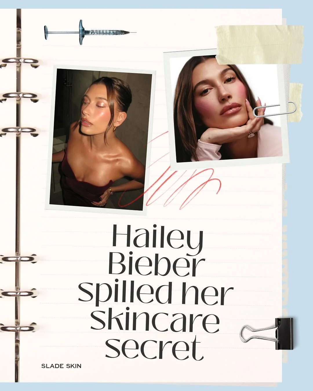 Think of it as the ultimate &ldquo;clean girl&rdquo; treatment. 

Ready for your Bieber-level glow?

✨ Book your appointment at Slade Skin
📍Available in-office or by virtual consult

#utahinjector #pleasantgrove #ezgel #ezgelprf #mucroneedling #slad