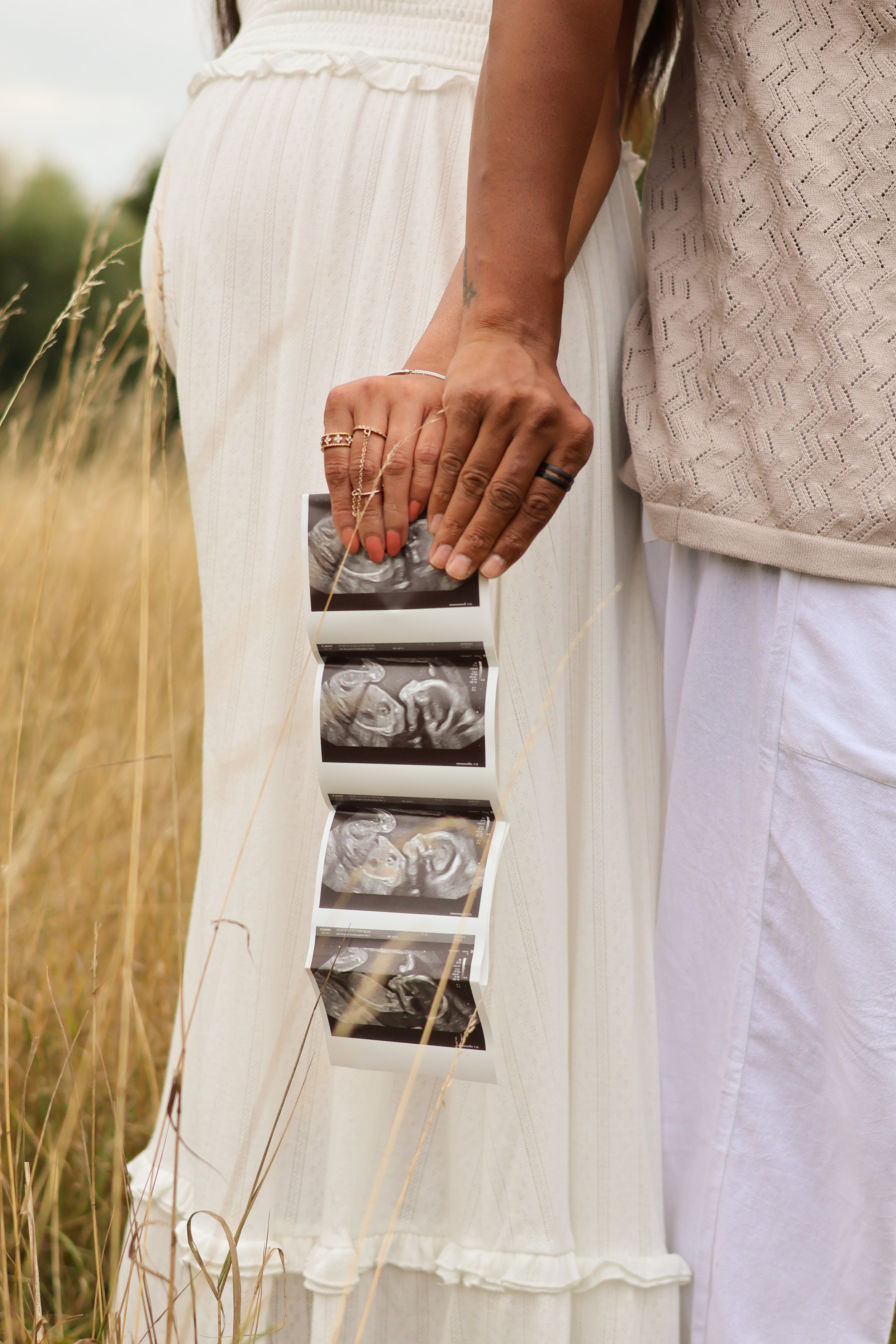 A couple is standing in a field, holding ultrasound images of a baby between them.