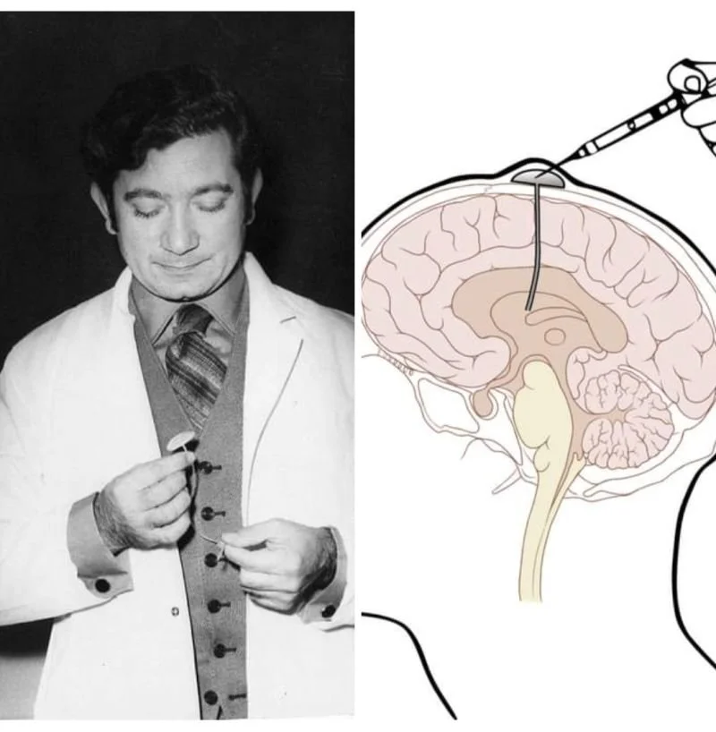 Dr. Ommaya, medical inventor and neurosurgeon.