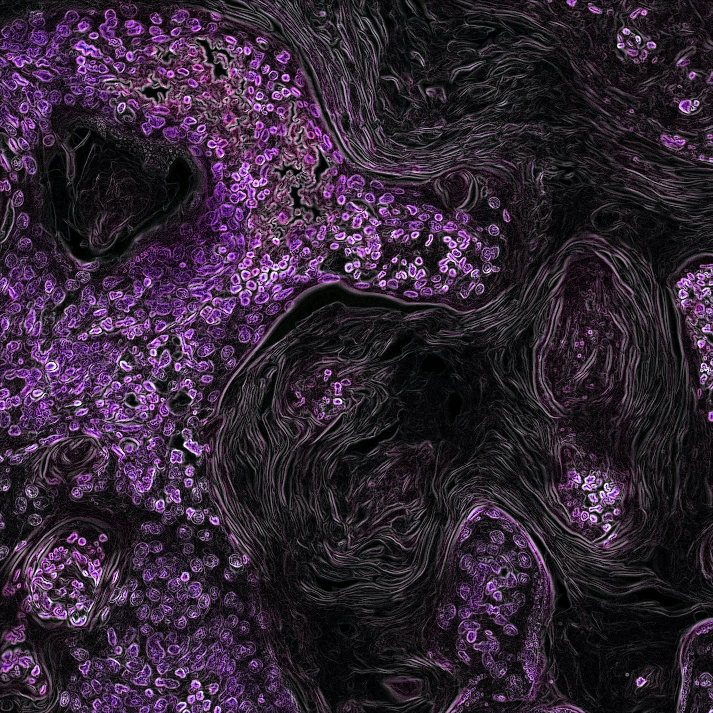 Nature, Nurture & Neurobiology: Roots of EDs