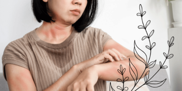 Histamine, Anxiety, and Nervous System Dysregulation