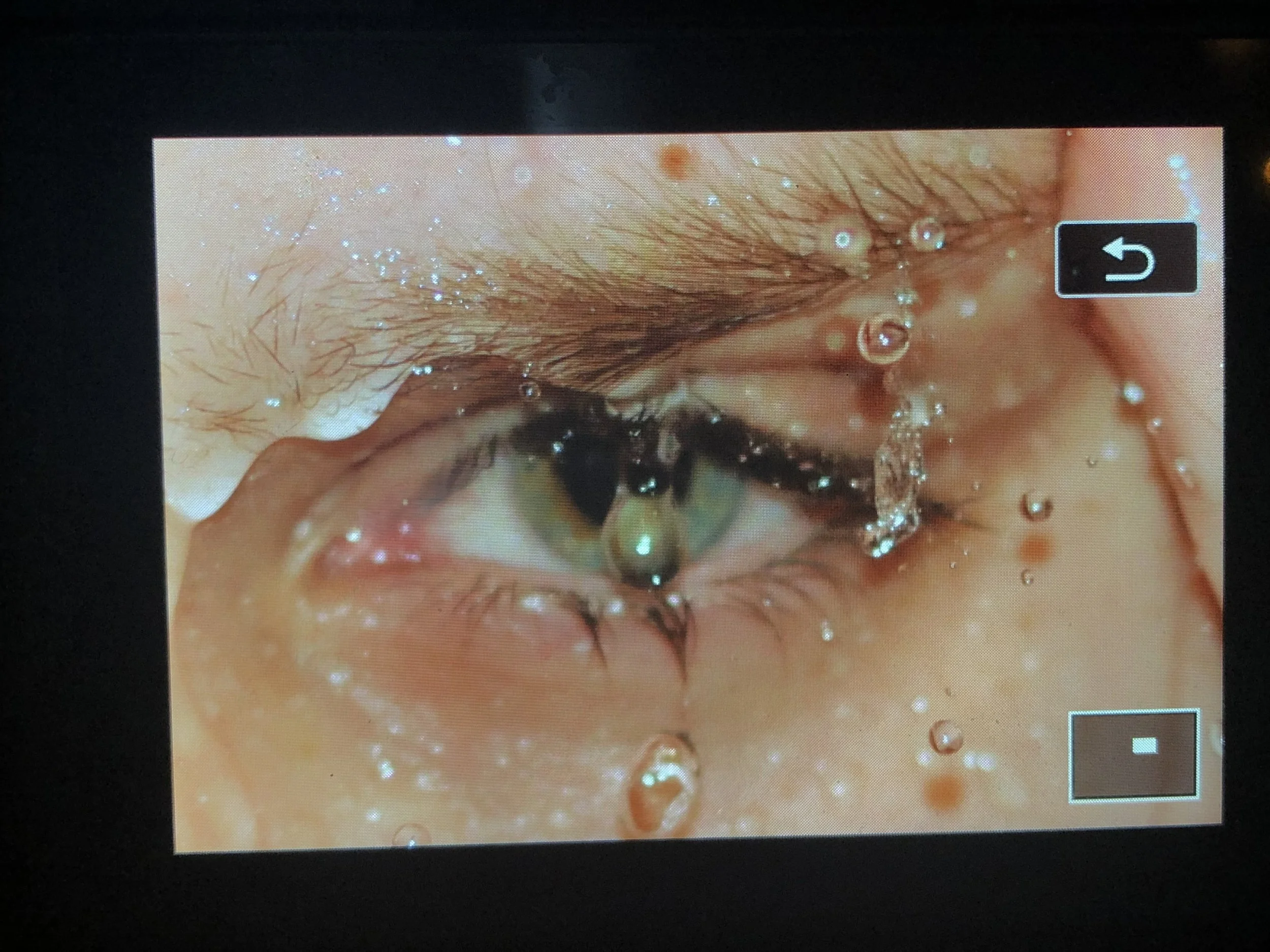 Close-up of a human eye with water droplets on the eyelid and surrounding skin.