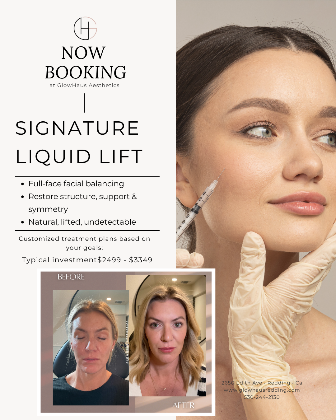 Before and after Signature Liquid Lift treatment showing full-face rejuvenation with restored volume, improved facial balance, and natural-looking lifted results at GlowHaus Aesthetics in Redding, CA.