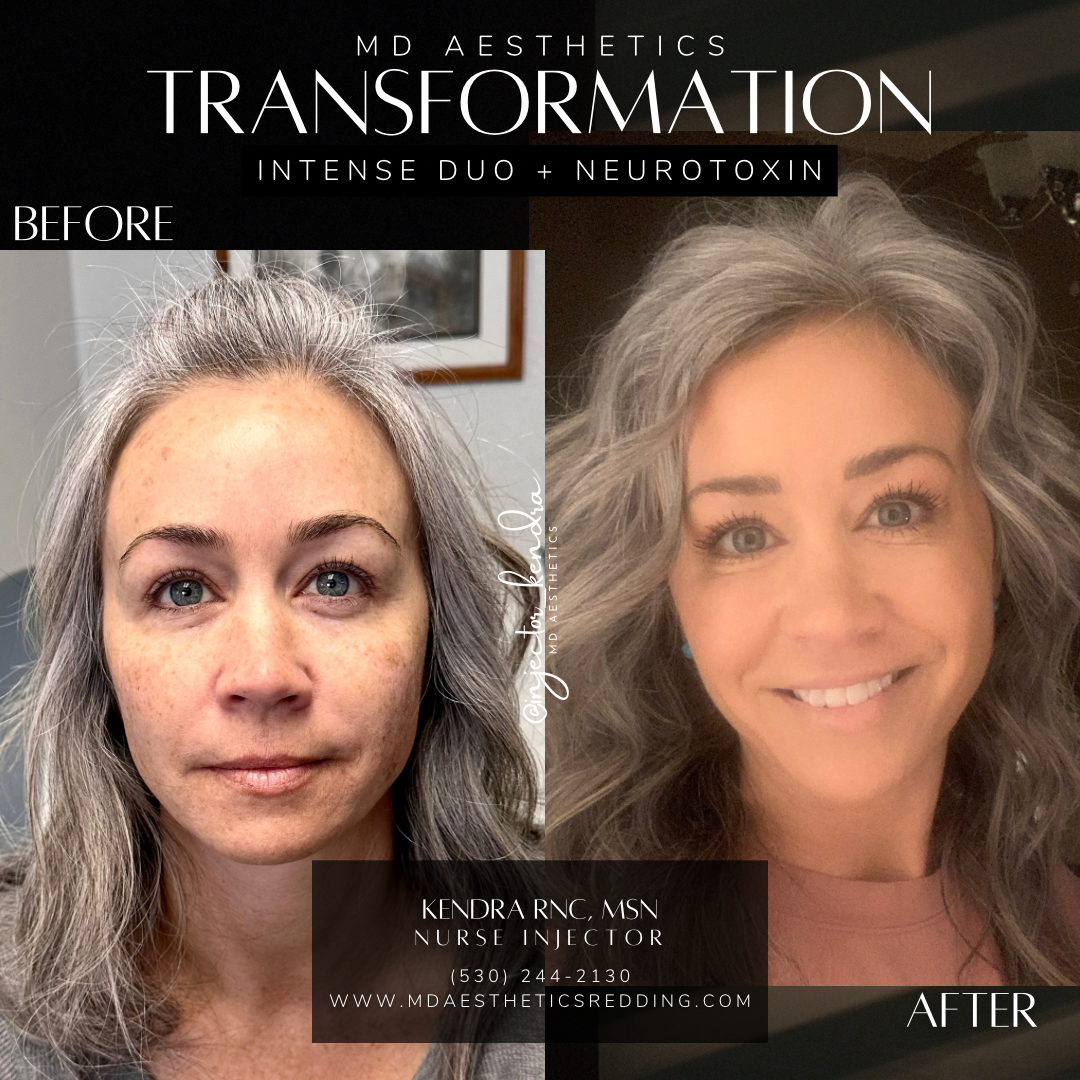 Copy of Square Posts  40 Botox.PNG