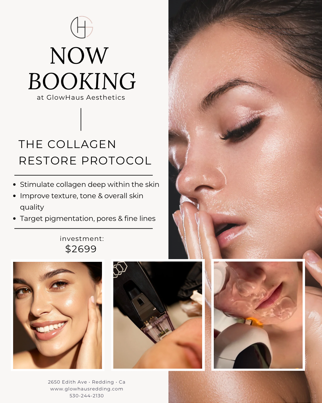 Collagen Restore Protocol treatment combining Morpheus8, Lumecca IPL, and biostimulators to improve skin texture, tone, and collagen production for smoother, brighter, youthful skin at GlowHaus Aesthetics in Redding, California.