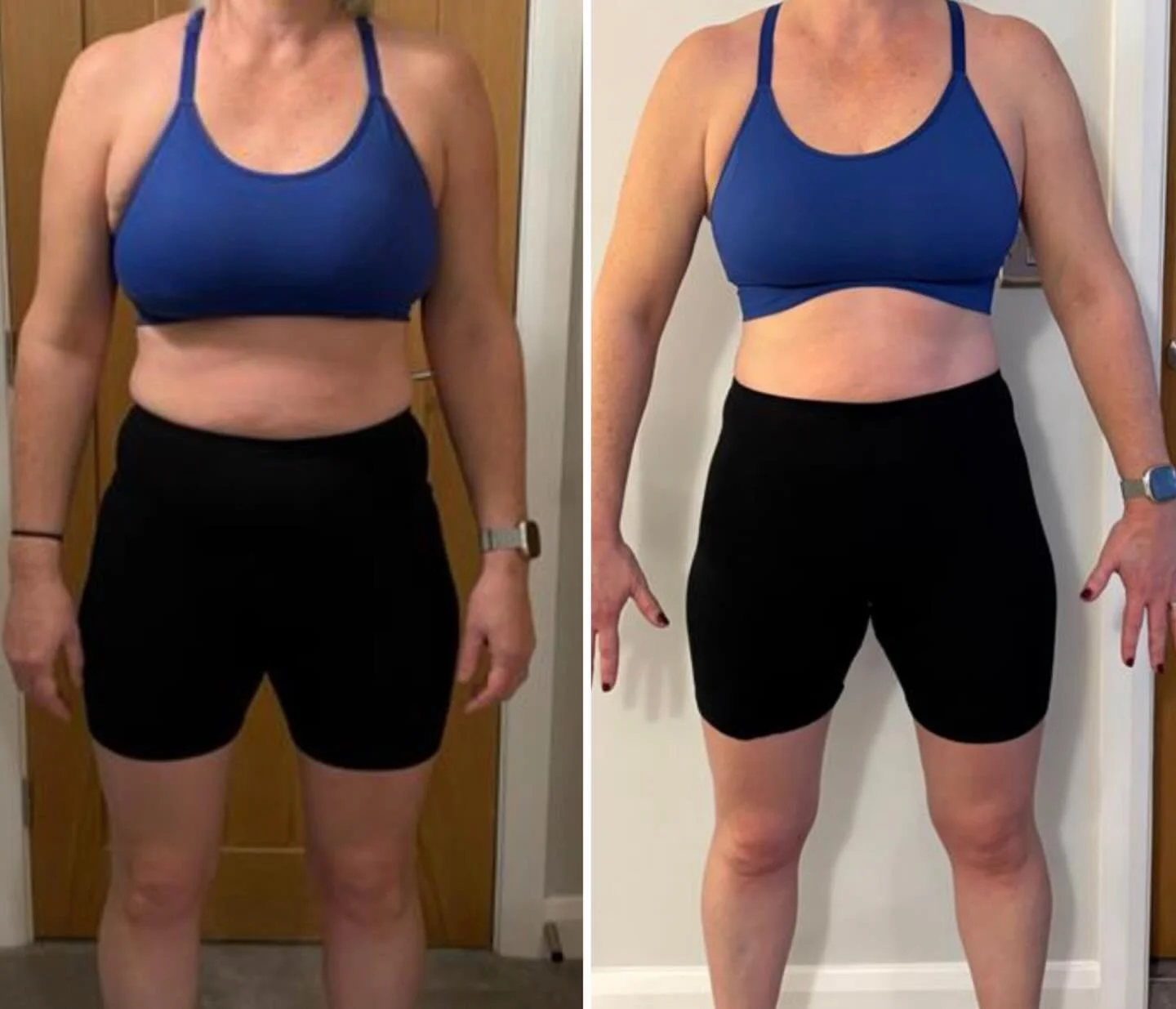 6 weeks. No magic. Just consistency. 👏

Same client.
Same clothes.
6 weeks apart.

✔️ Stronger
✔️ Leaner
✔️ More confident
✔️ Standing taller

This is what happens when you:
&ndash; Train properly
&ndash; Eat enough
&ndash; Stop starting over
&ndash