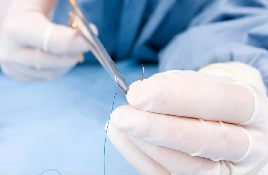 Do Urgent Cares Do Stitches? Laceration Repair in Battle Creek