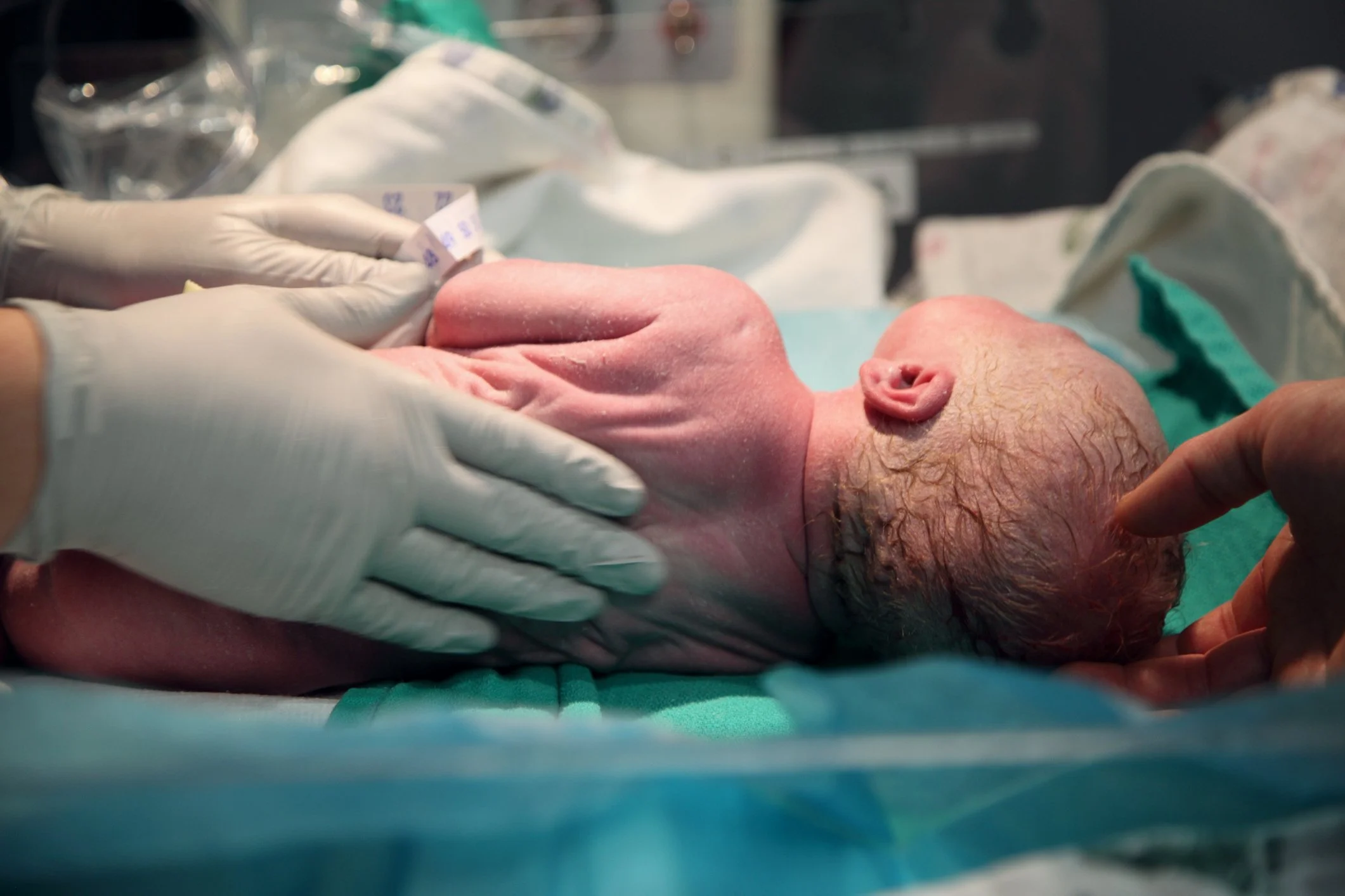 Newborn baby being delivered in a hospital operating room with medical staff wearing gloves.