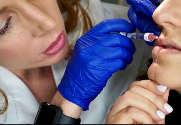 derma filler injections