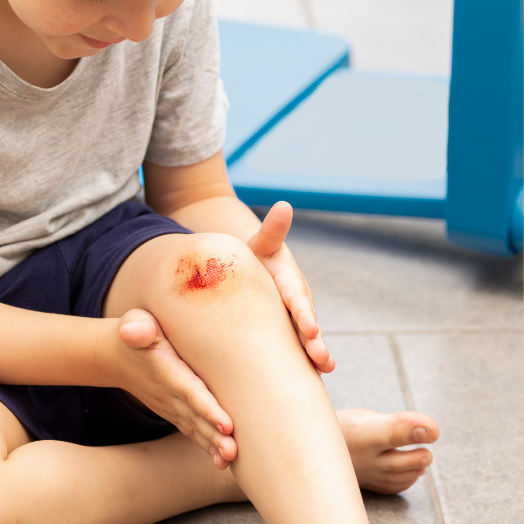From Scraped Knees to Stitches: Navigating Summer Ouchies with WanderCARE