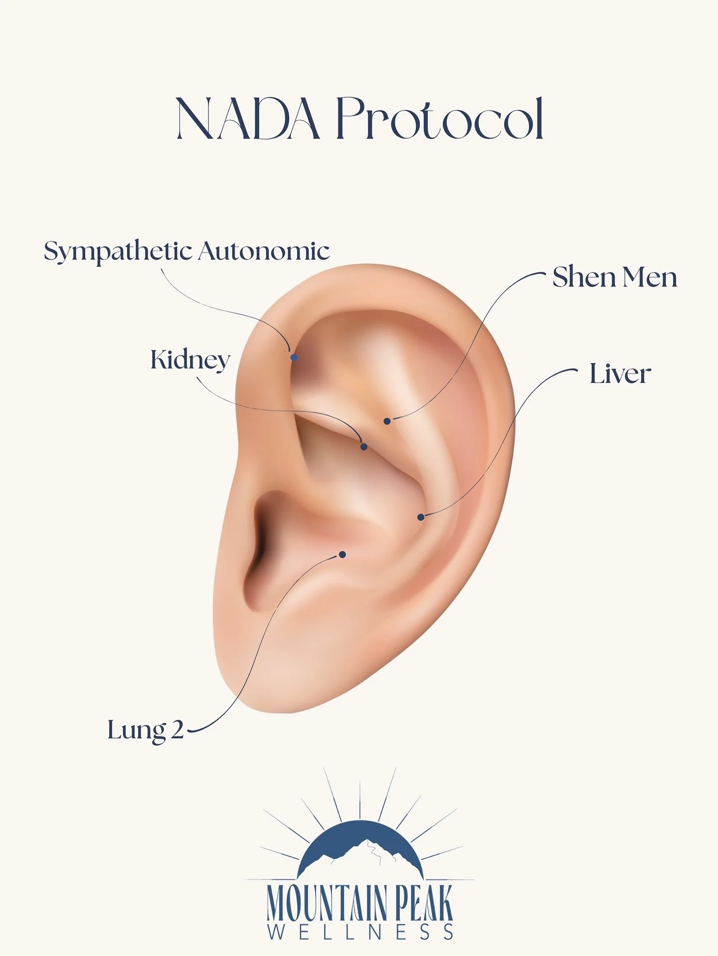 The NADA Protocol &mdash; A gentle but powerful 5-point ear acupuncture treatment that supports:
😩 Stress relief
🧼 Detoxification
🧘&zwj;♀️ Emotional balance
💜 PTSD &amp; trauma recovery
🤝 Addiction support

NADA stands for the National Acupunctu