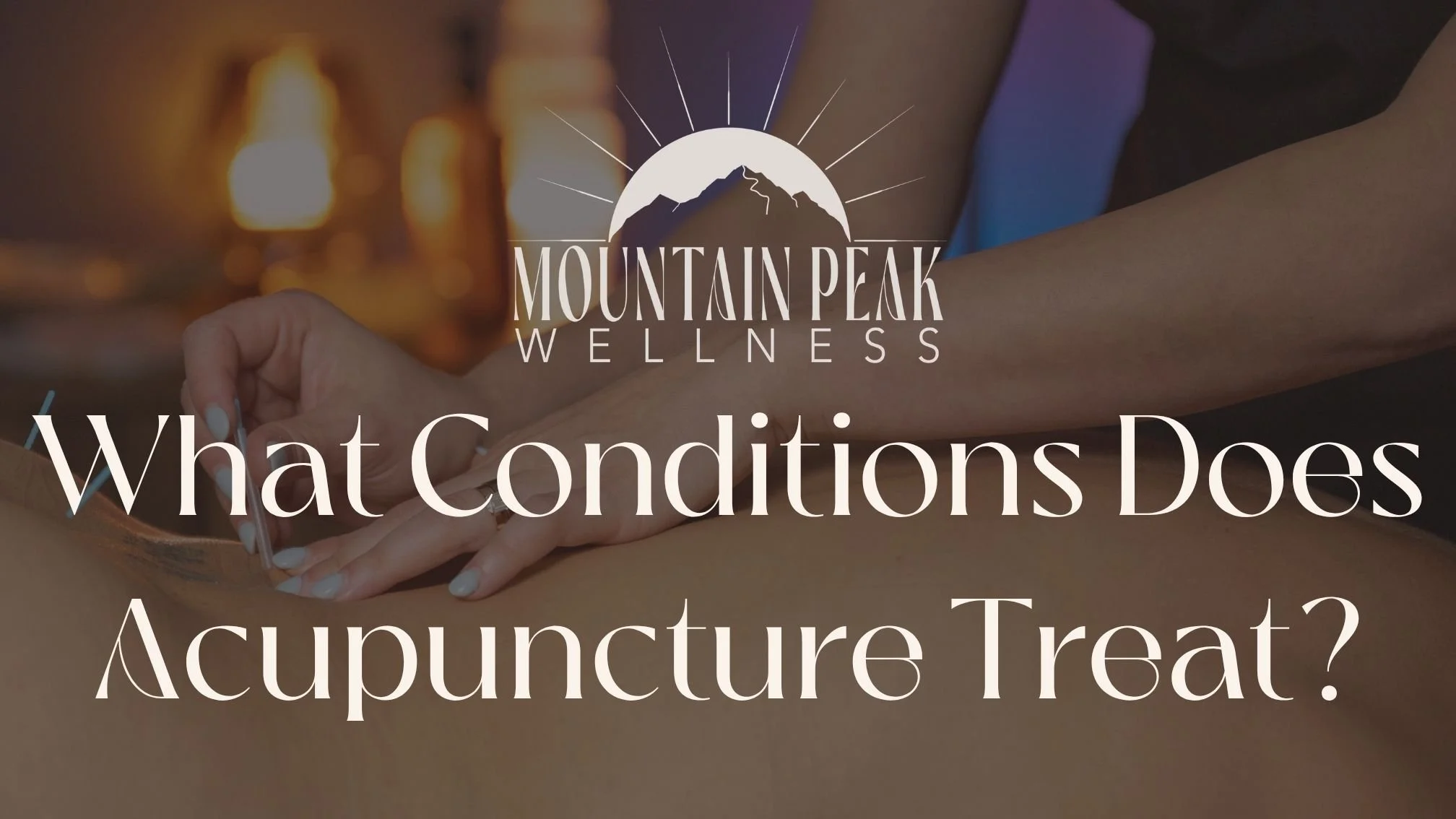 What Conditions Does Acupuncture Treat? A Guide for Evergreen, CO Patients