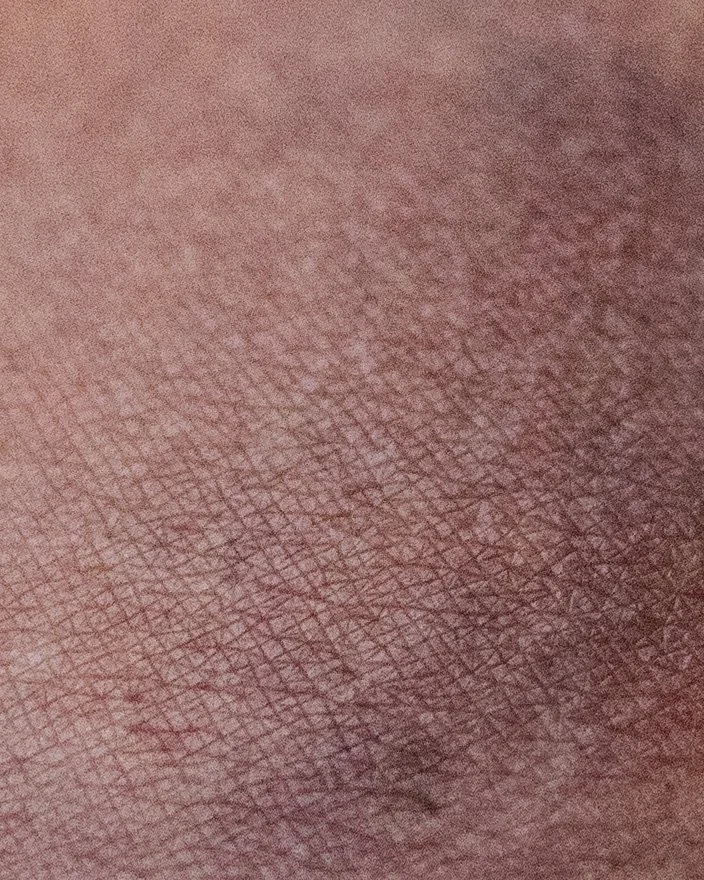 Clara Jeanne Reed
Bruise II
2025
Archival pigment print on Red River Polar Matte
Edition of 5
15 x 12 inches
38.1 x 30.48 cm
CJR P6