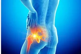 Hip Pain: What’s Really Holding You Back
