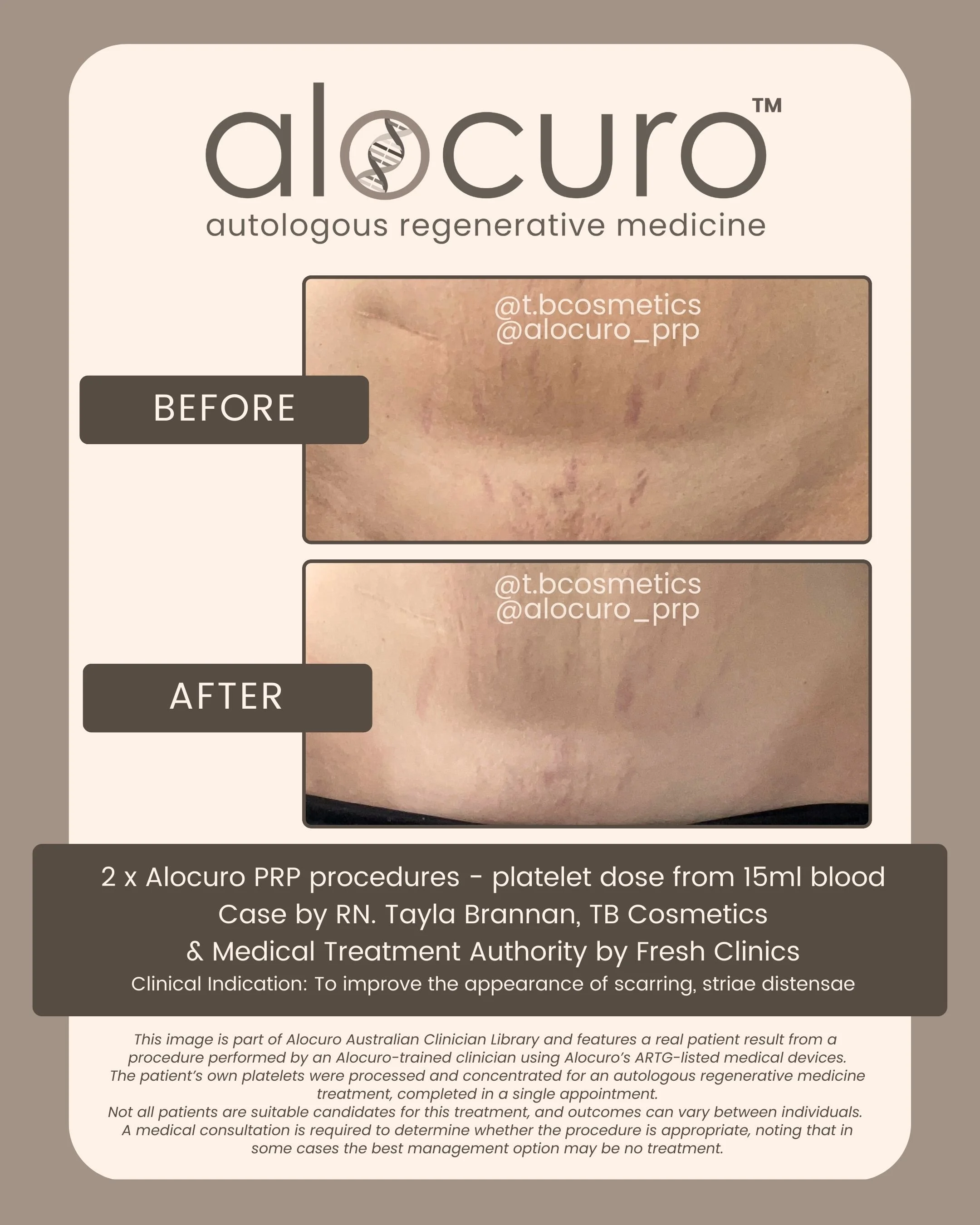 Alocuro Skin Case PRP - Before & After - 03.jpg