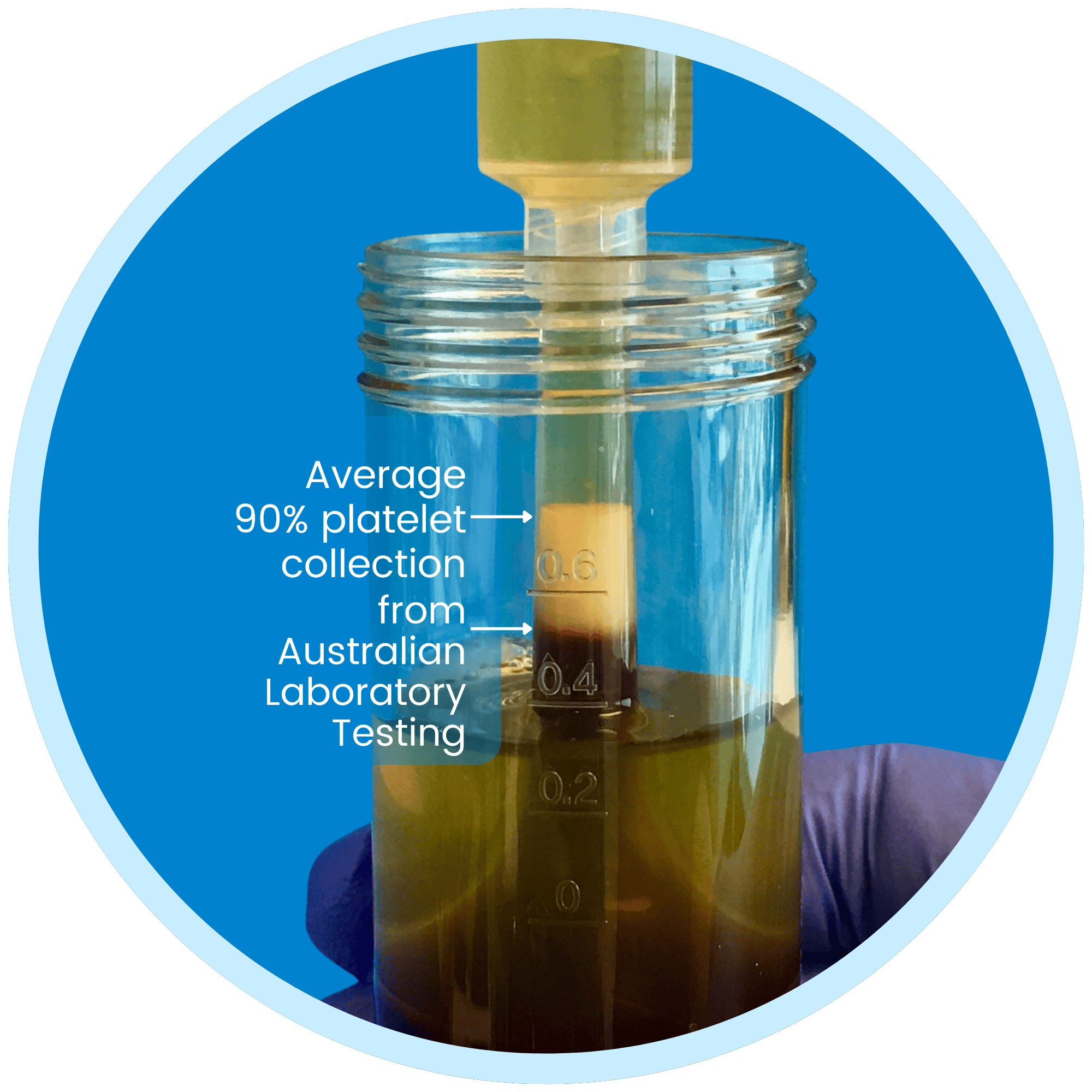 Highest platelet collection efficiency platelet rich plasma Australia