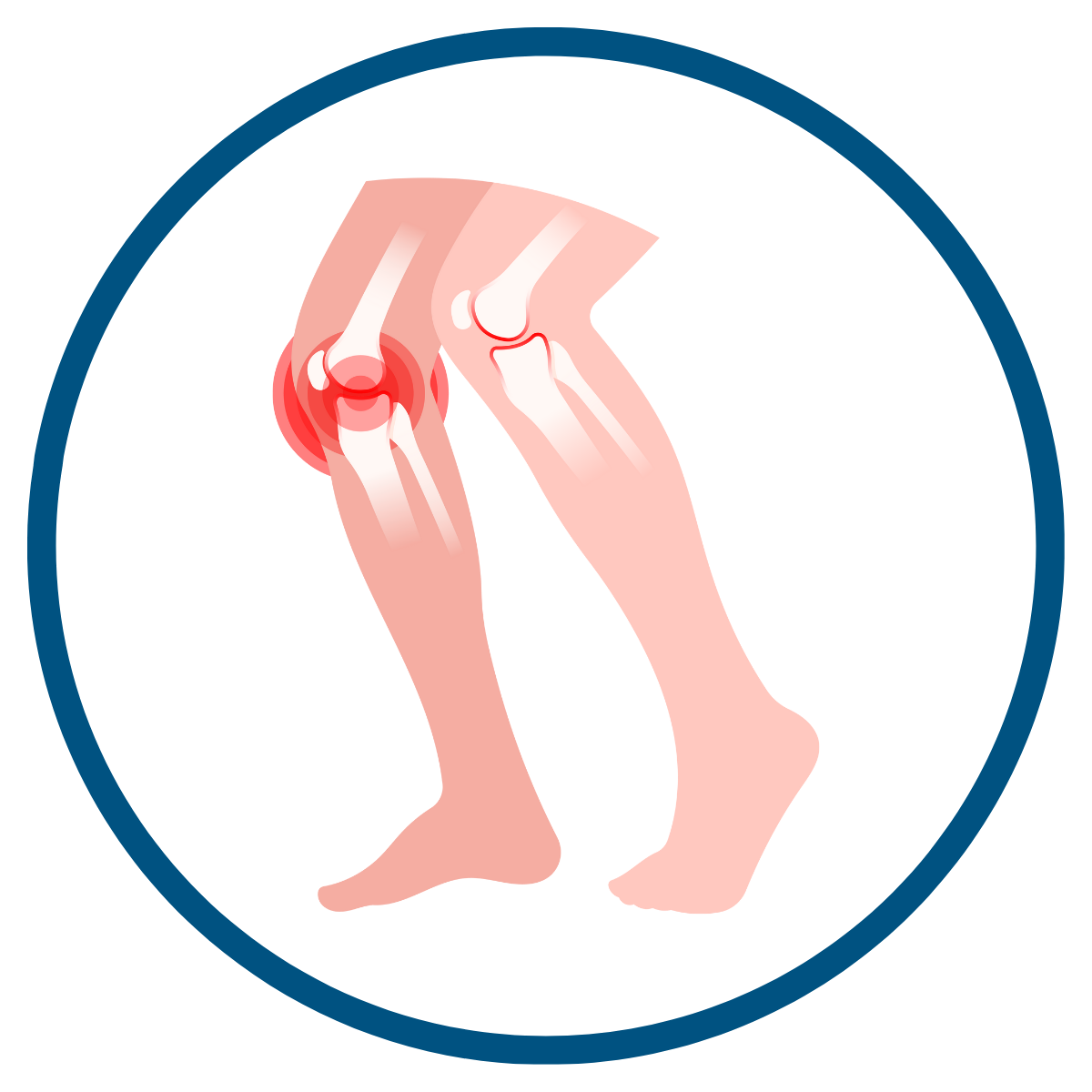 Alocuro PRP systems support protocol-led preparation for musculoskeletal joint and soft-tissue applications.