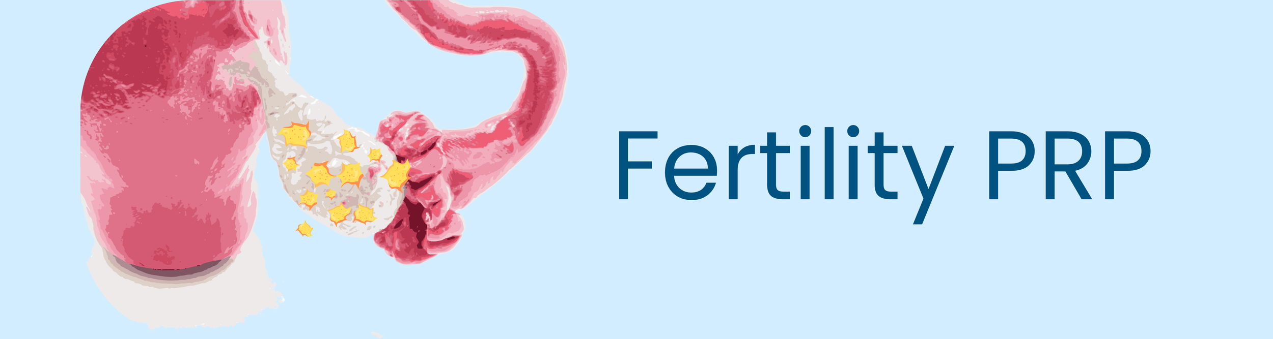 Alocuro fertility PRP for endometrial and ovarian health