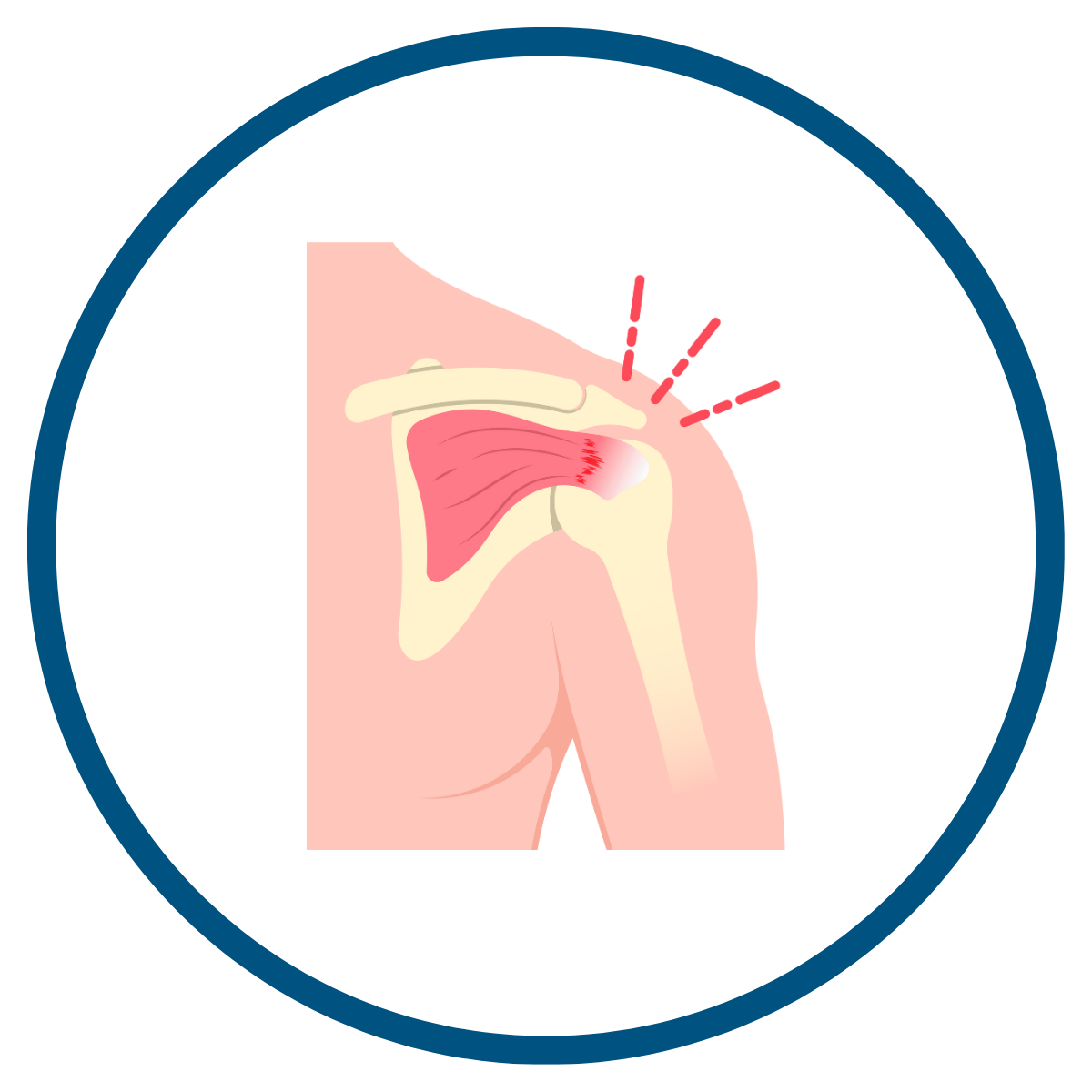 Designed to allow adjustment of platelet concentration and leukocyte inclusion for MSK protocols.