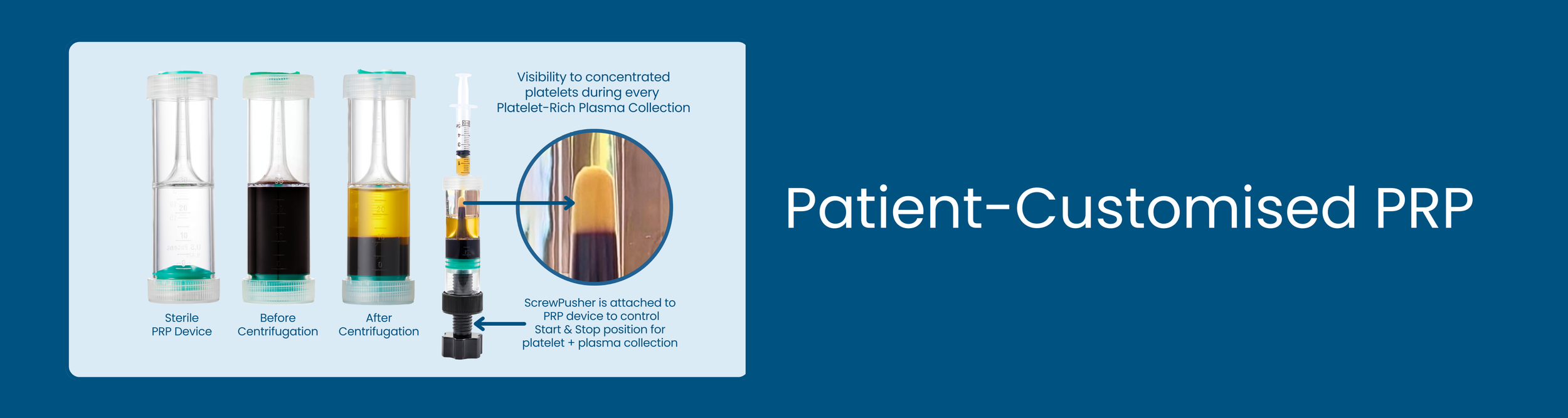 Fully customisable high platelet dose PRP with optional leukocyte inclusion