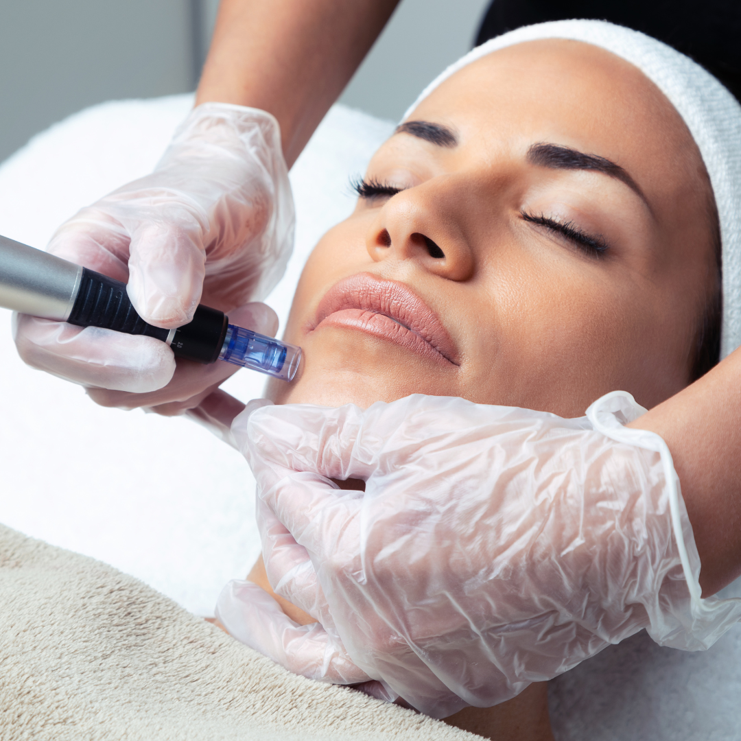Medspa in Tucson, AZ 85710 l Microneedling Near Me