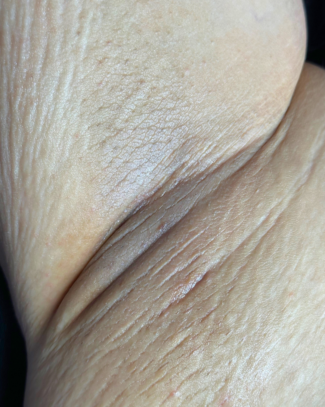 underarm.png
