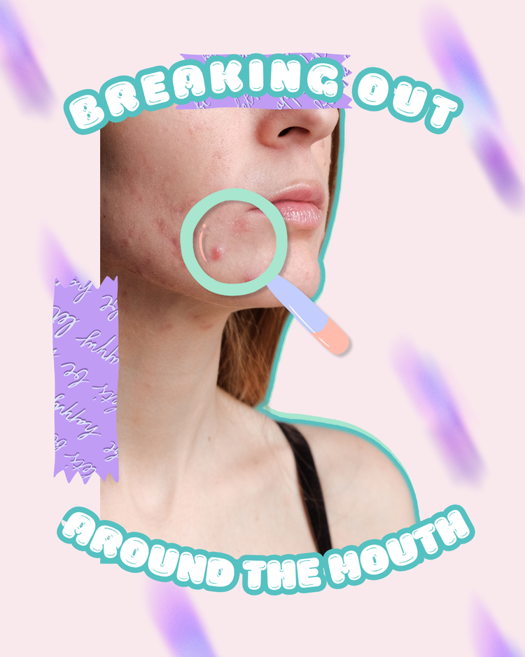 Breakouts Around Your Mouth? Here’s What Might Really Be Causing It