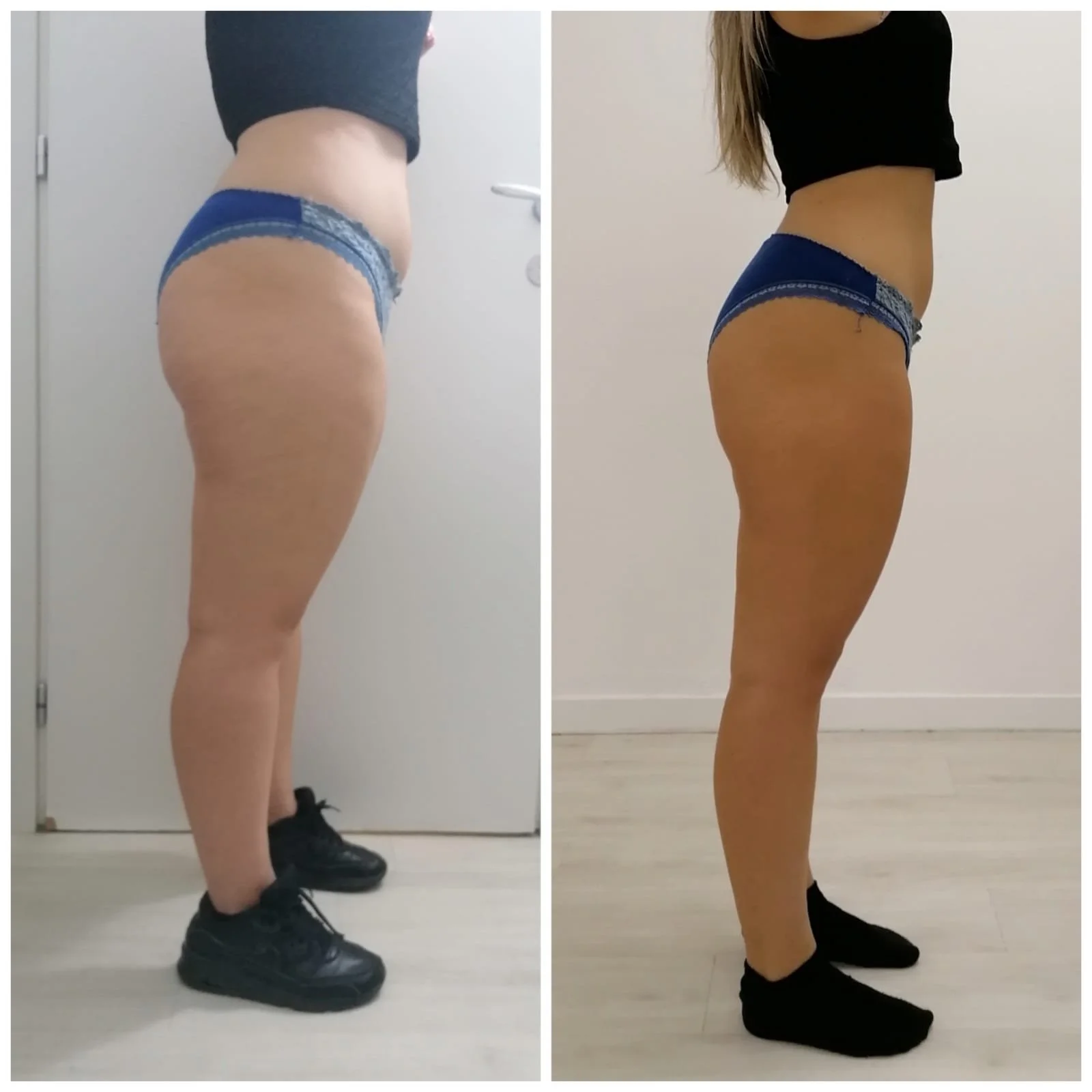 After 3 treatments.jpeg