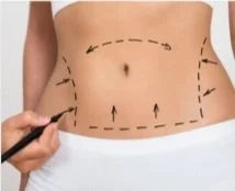 body-sculpting-1.jpg
